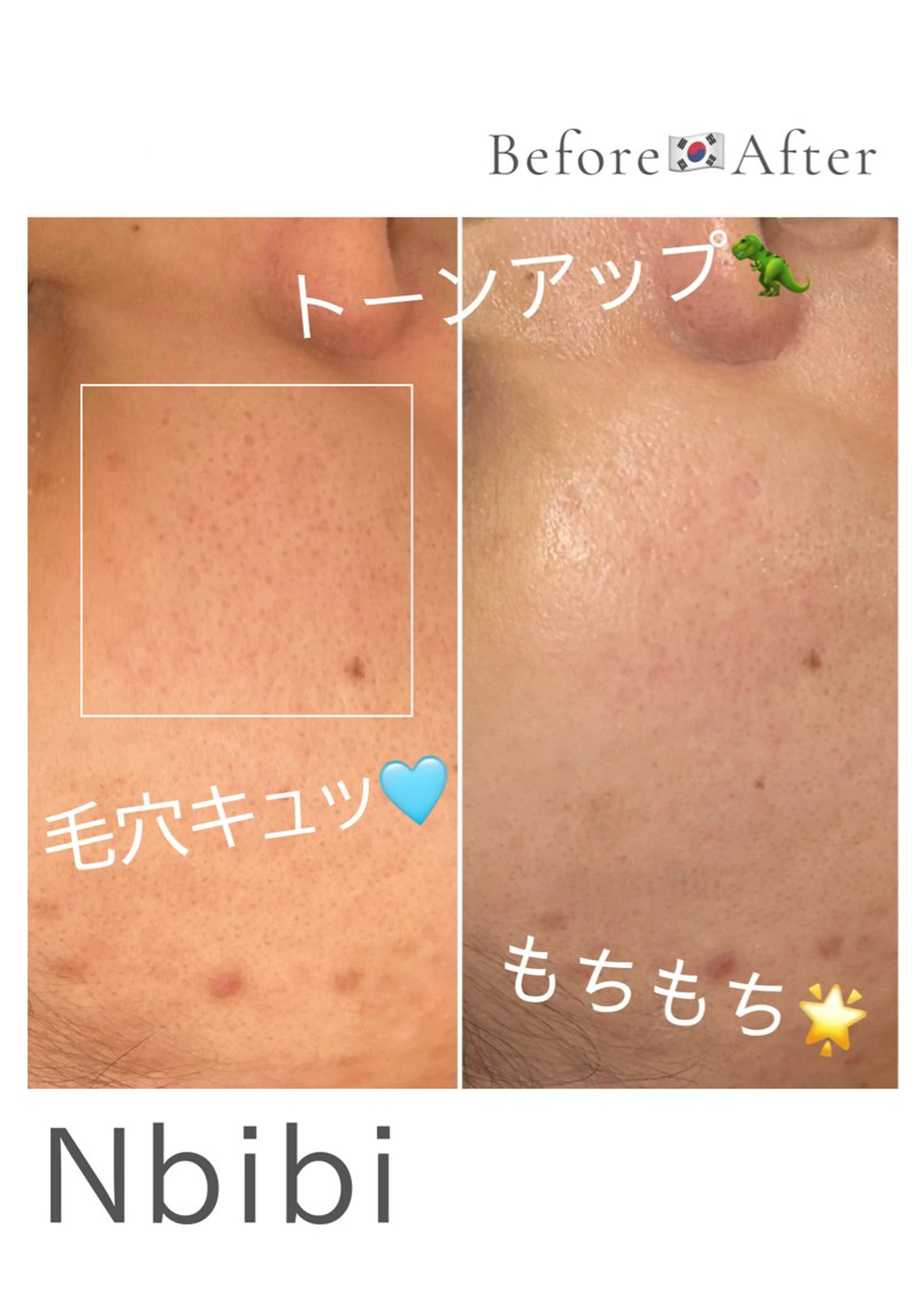 韓国🇰🇷価格 サロン_Nbibiのエステ・リラクイメージ