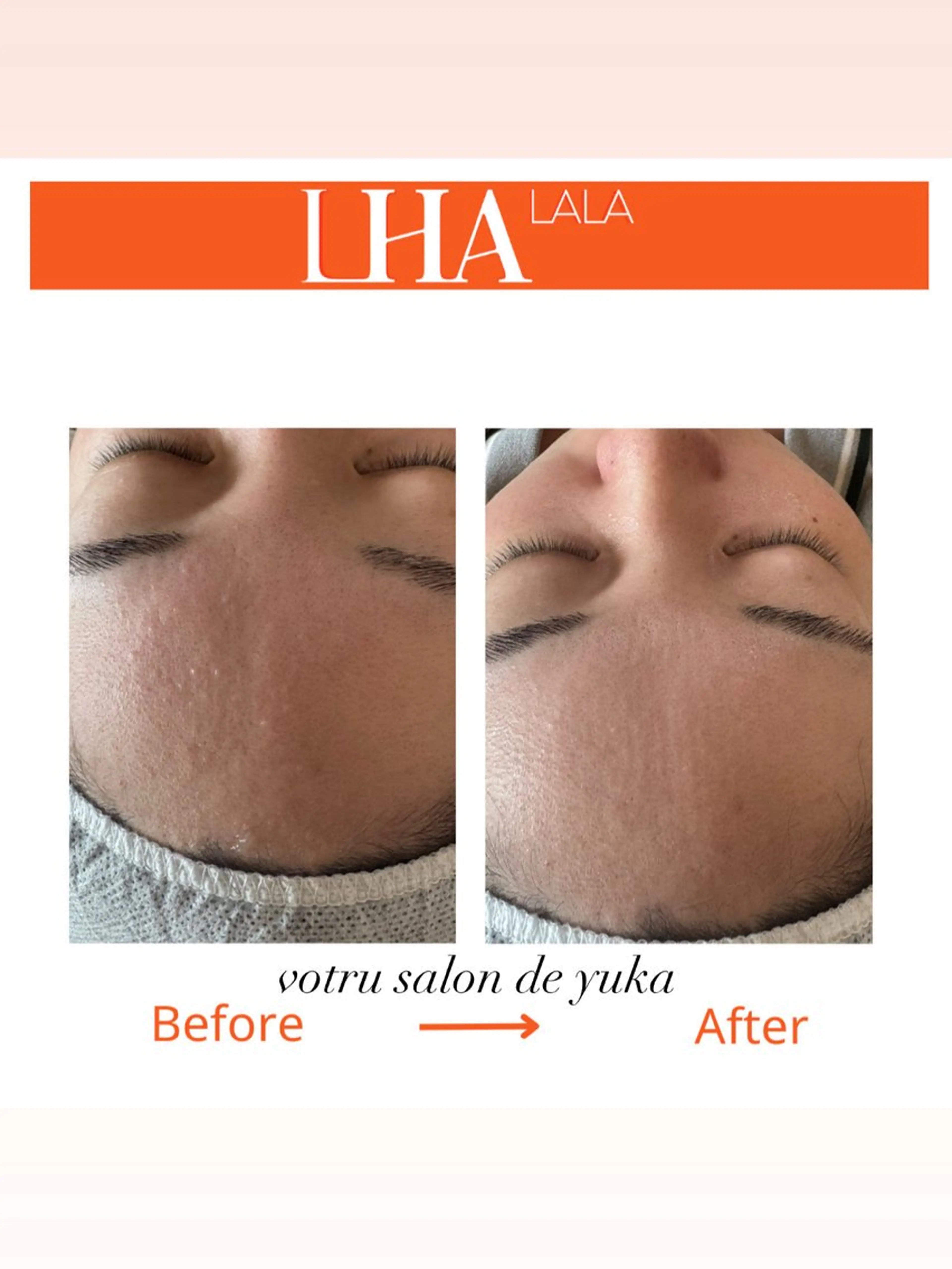 エステ Votru Salon de  Yuka所属・votrusalon deyukaのエステ・リラクイメージ