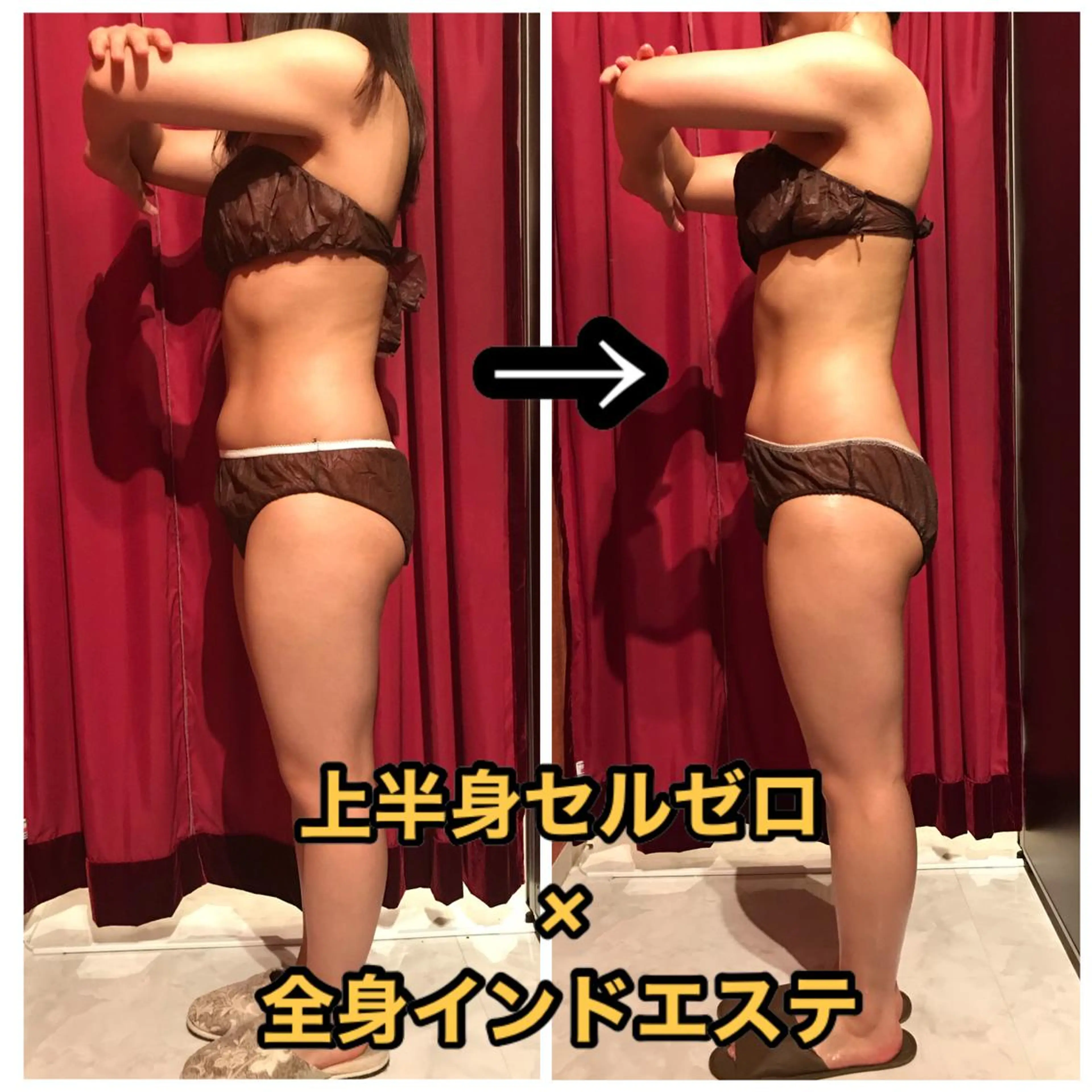 Cielo(シエロ) ダイエット専門店のエステ・リラクイメージ