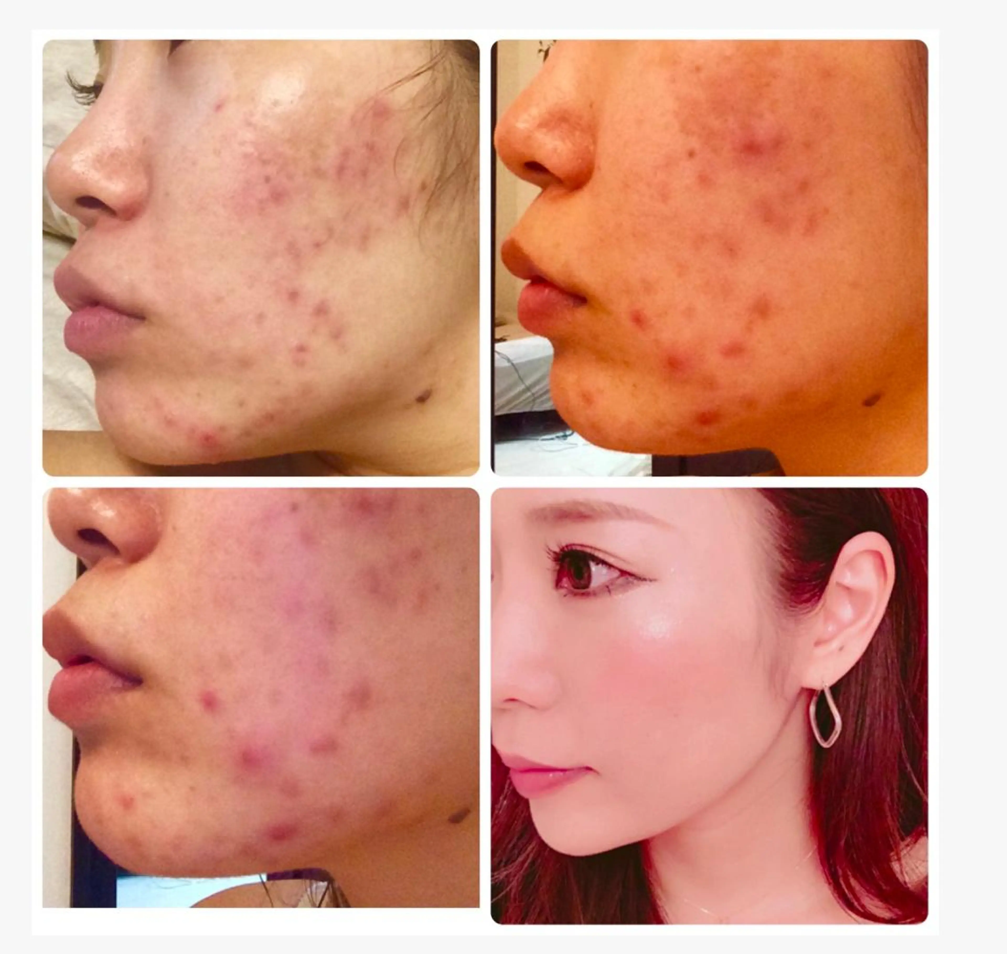 エステ フェイシャル専門 肌質改善/プランスのエステ・リラクイメージ