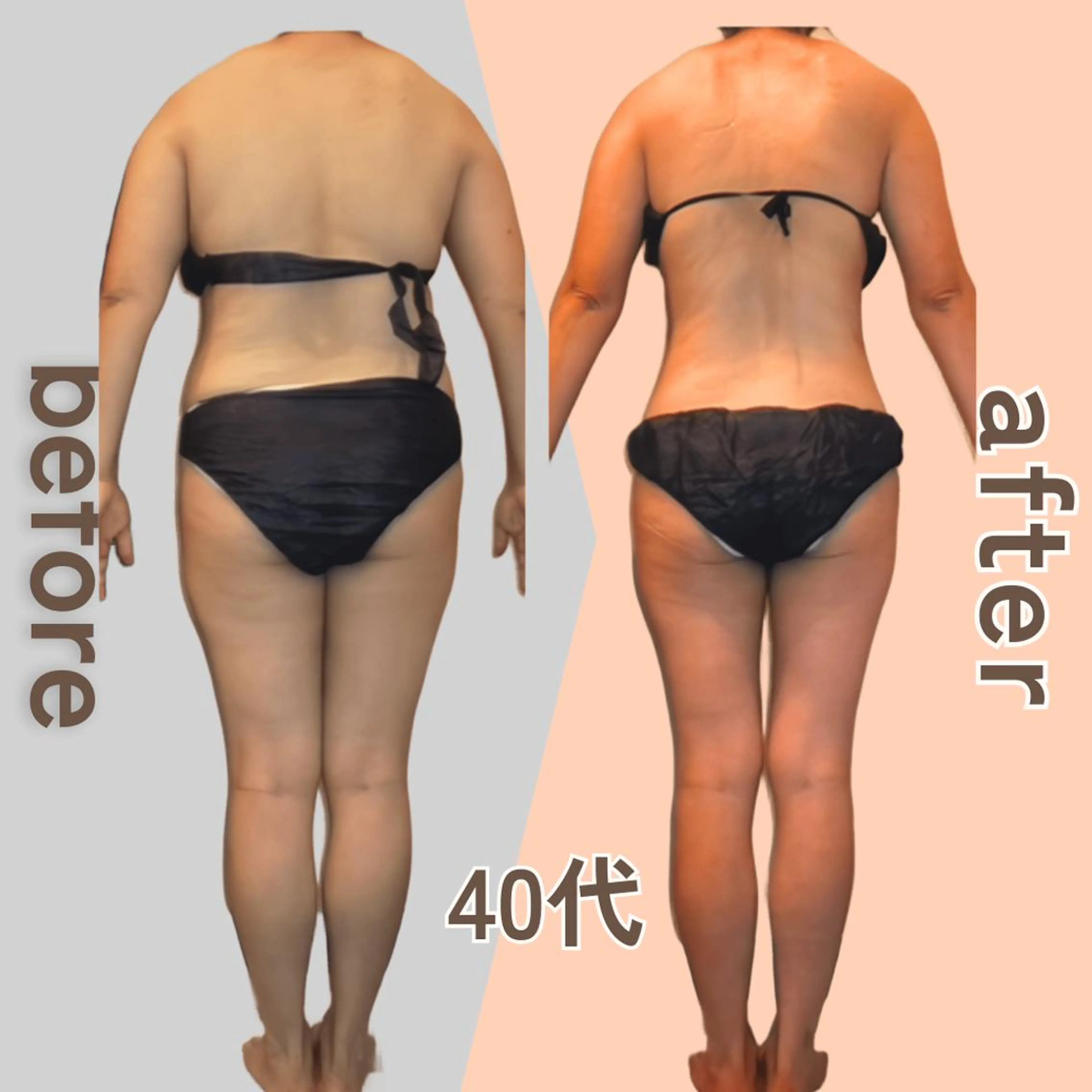 痩身エステ Julien麹町店のエステ・リラクイメージ