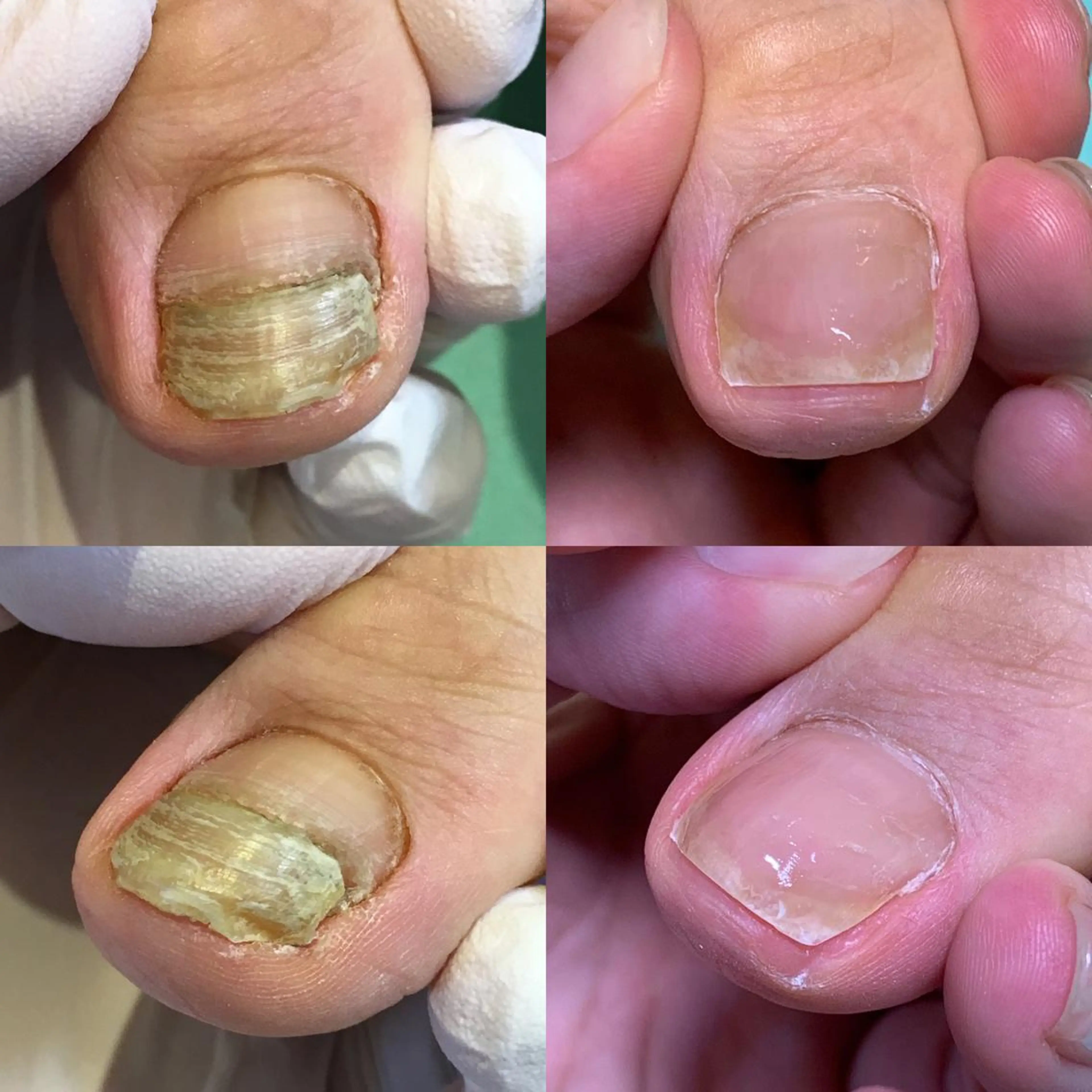 ネイル 東京巻き爪アカデミー所属・東京巻き爪 アカデミーのエステ・リラクイメージ