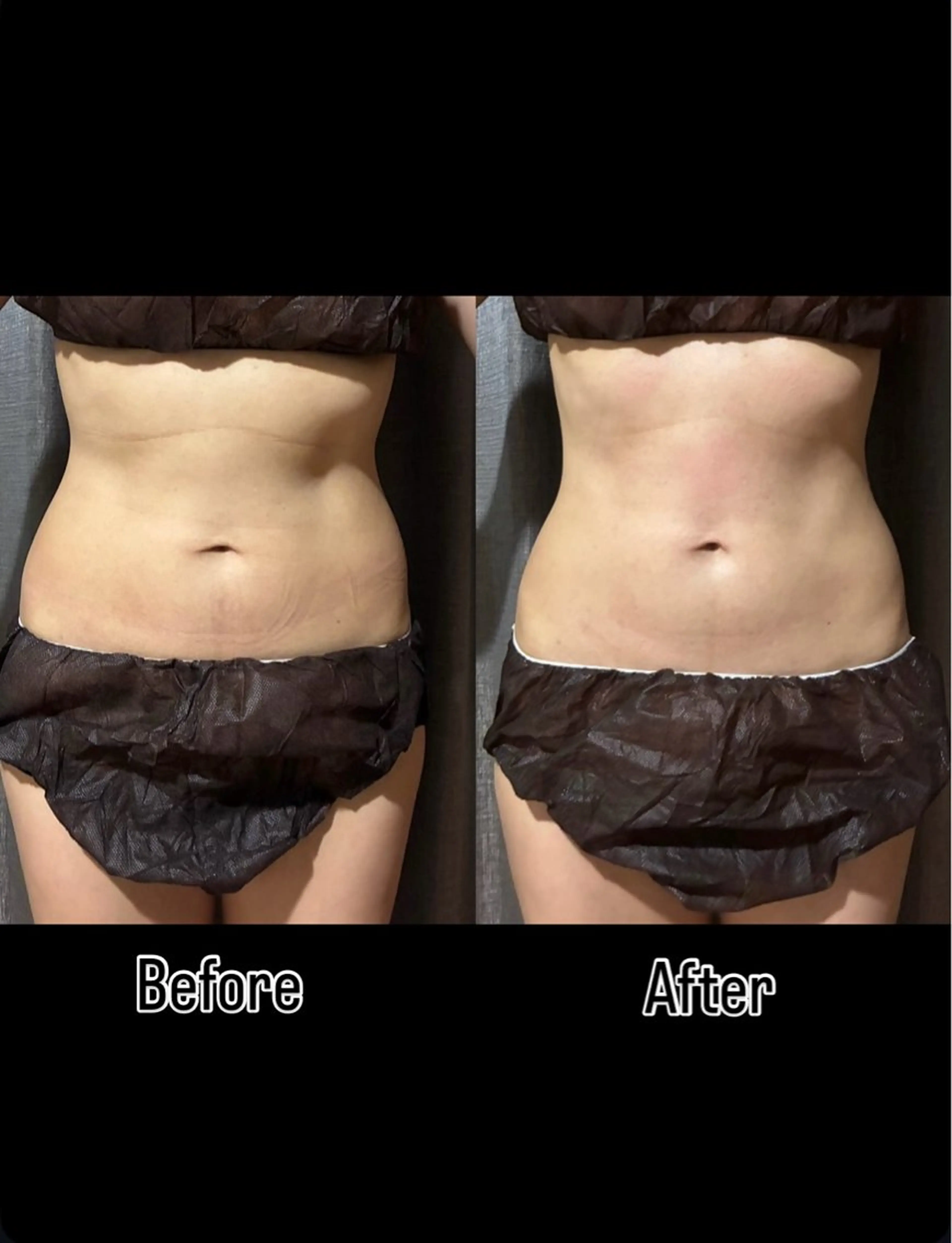 Lumiere所属・Lumiere （ルミエール）のエステ・リラクイメージ