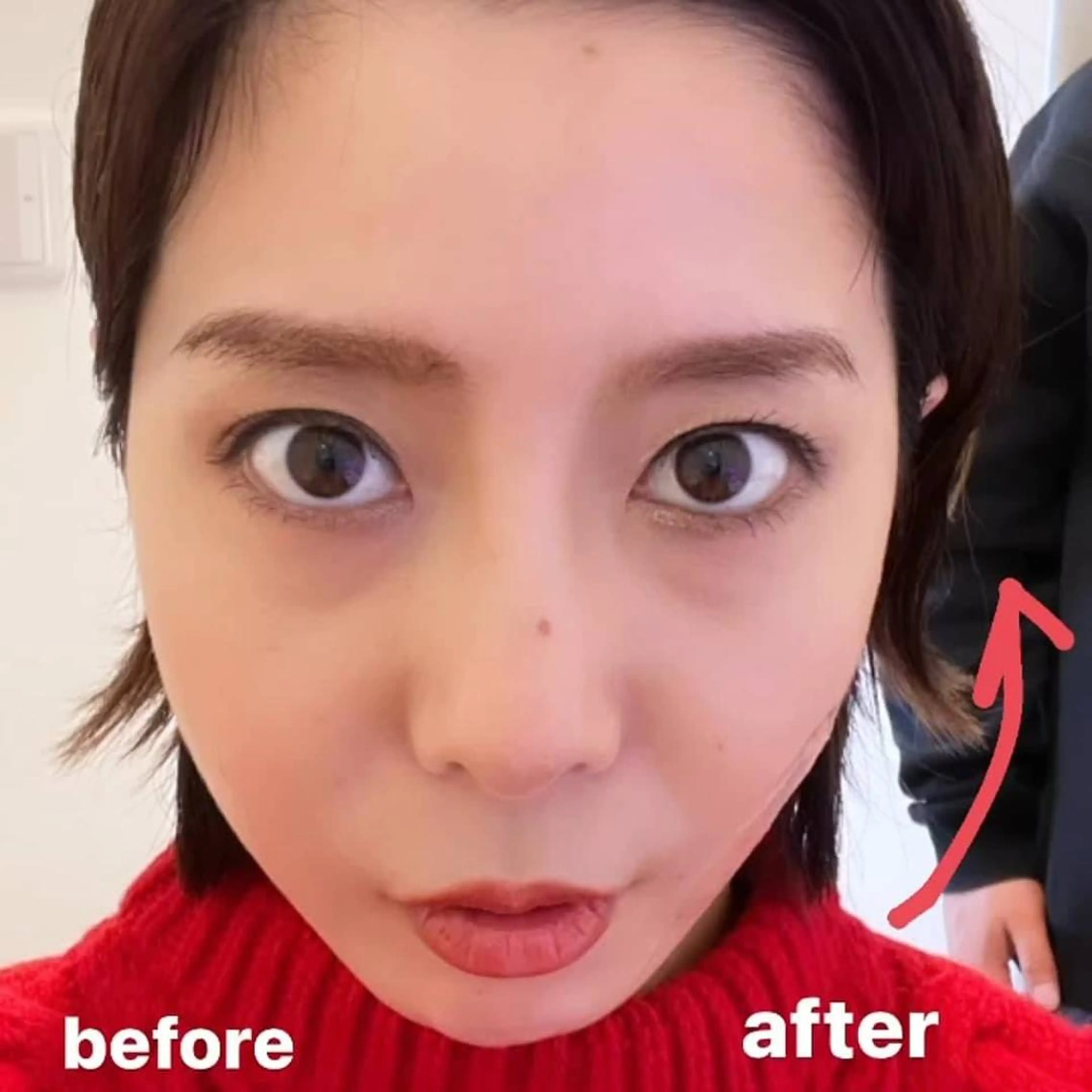 ☆初回限定☆セルフでしわ・たるみ・二重あごリフトアップ☆30分3278円の写真