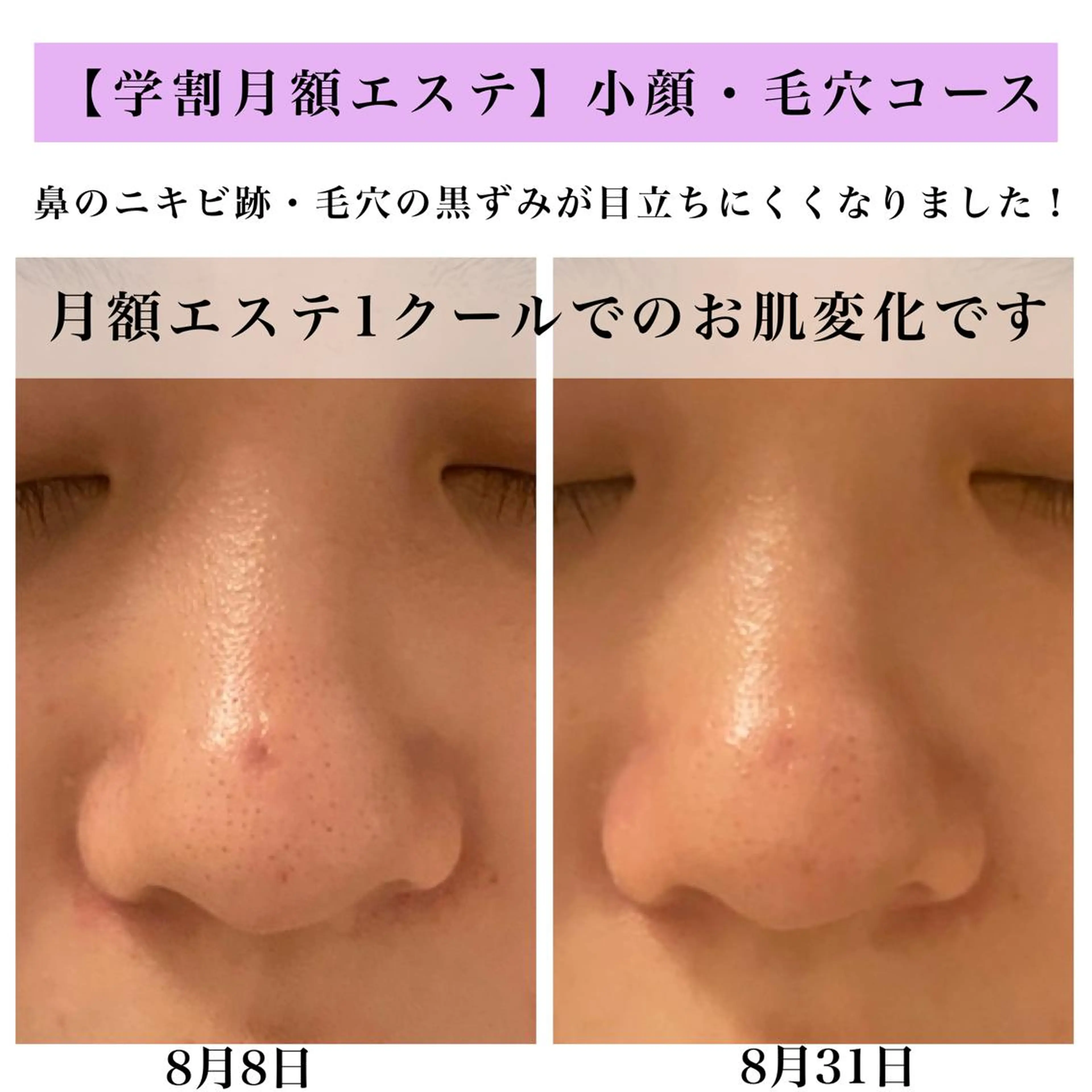 Bellesthe （ベルエステ）のエステ・リラクイメージ