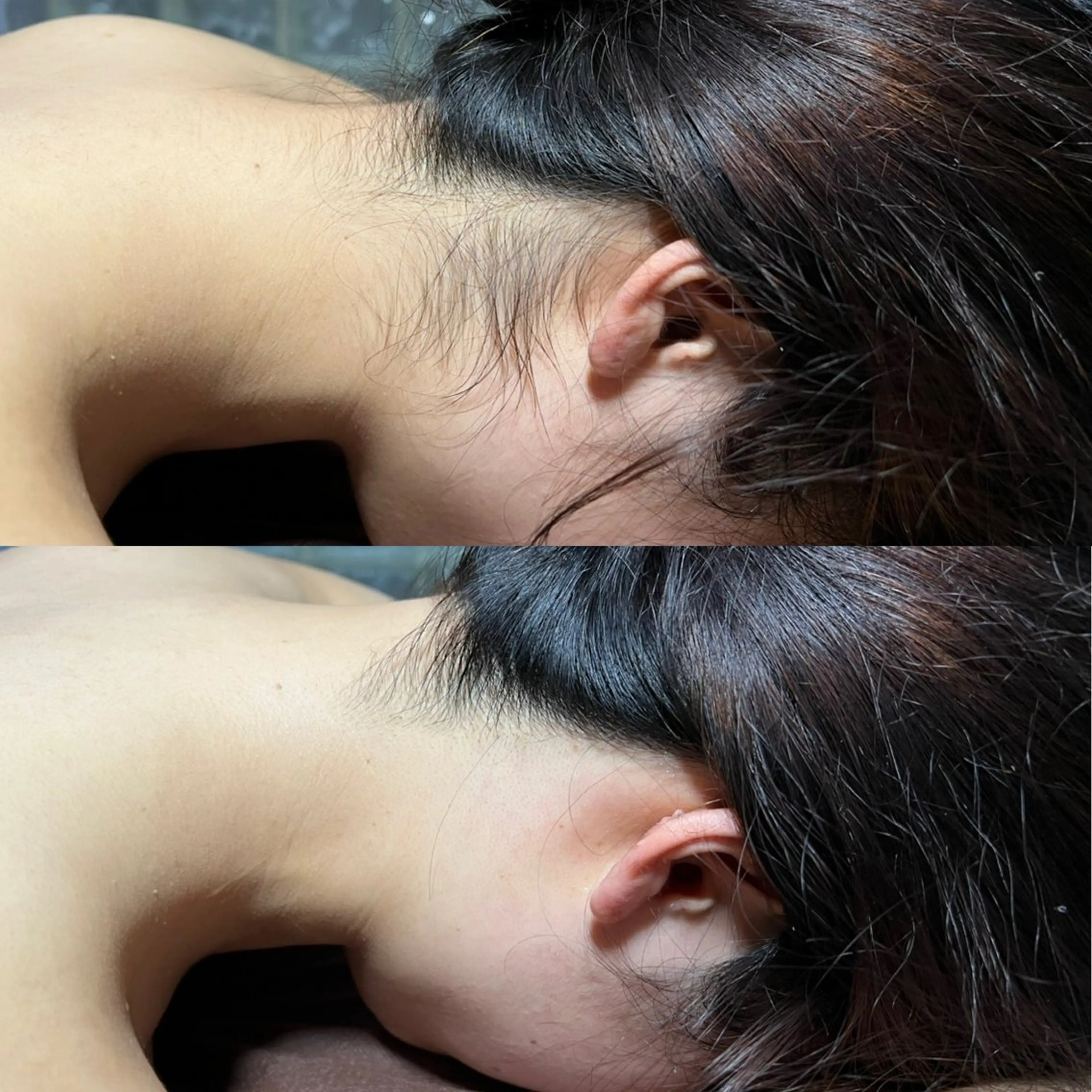 脱毛 Mr.&Ms. 脱毛 /眉毛ワックス/まゆのエステ・リラクイメージ