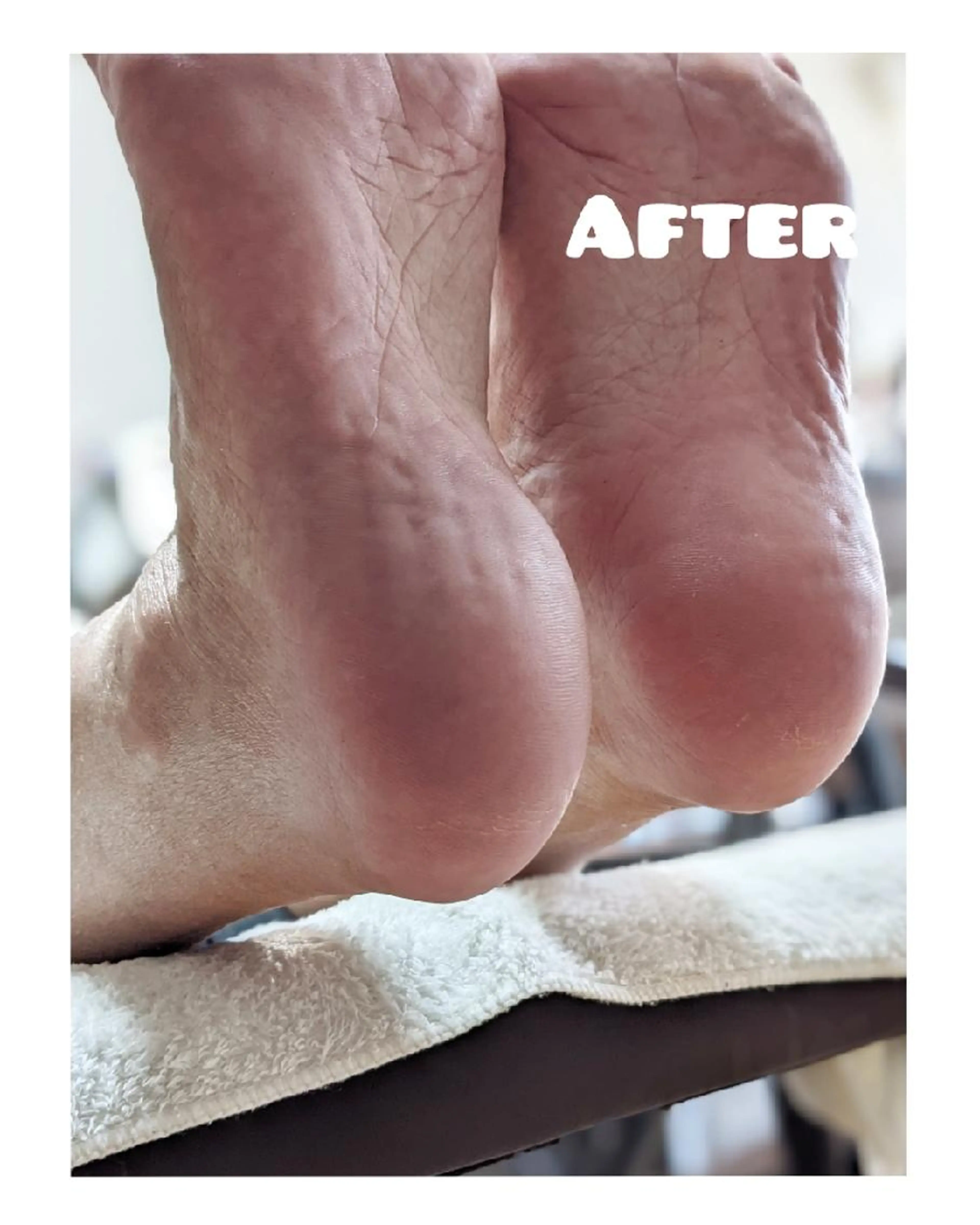 足裏角質ケアの写真