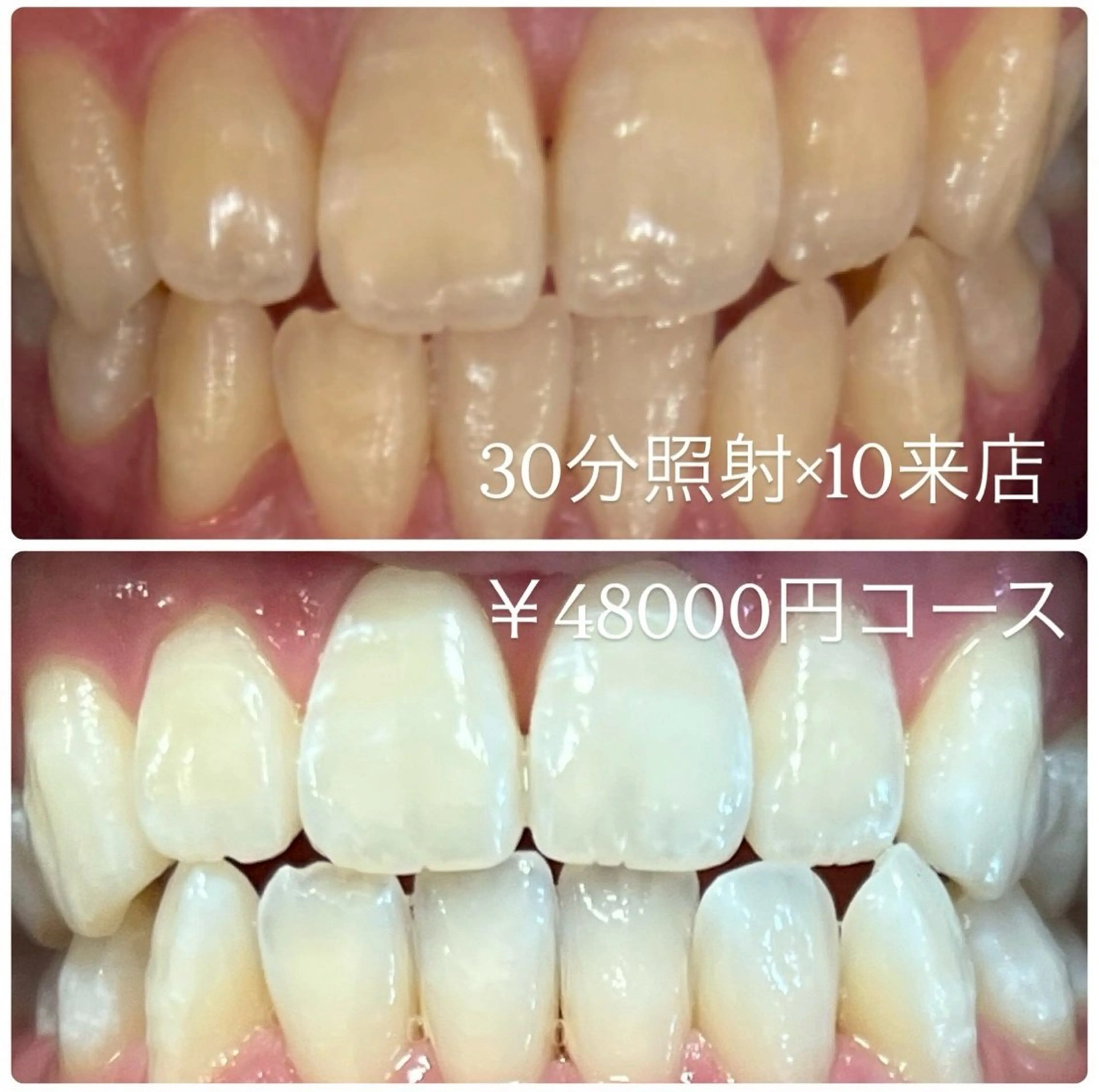 その他 PLATINUM Beauty 横浜店所属・ホワイトニングルーム 横浜店のその他イメージ