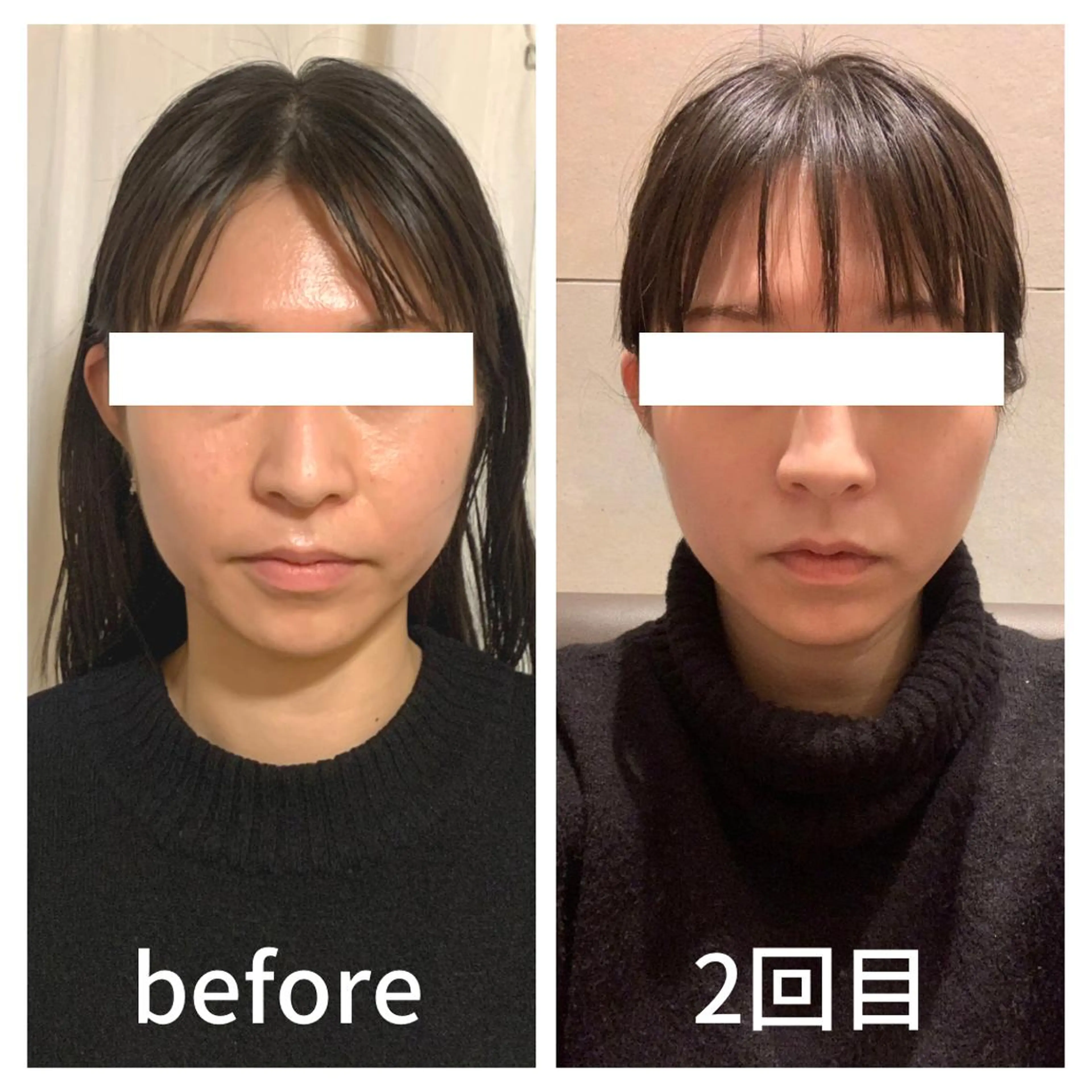 小顔サロン AMYONのエステ・リラクイメージ