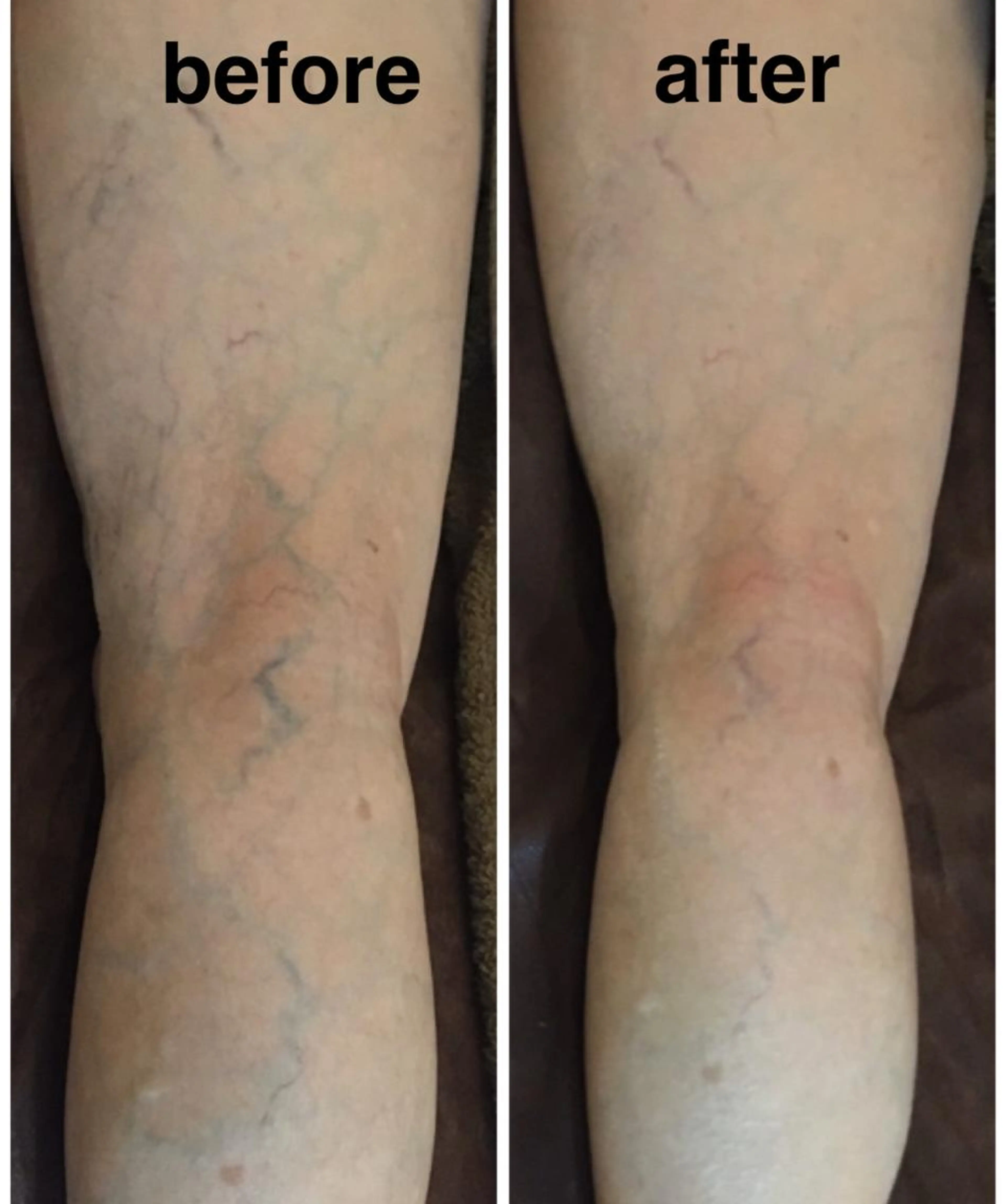 オールハンドリンパマッサージの写真