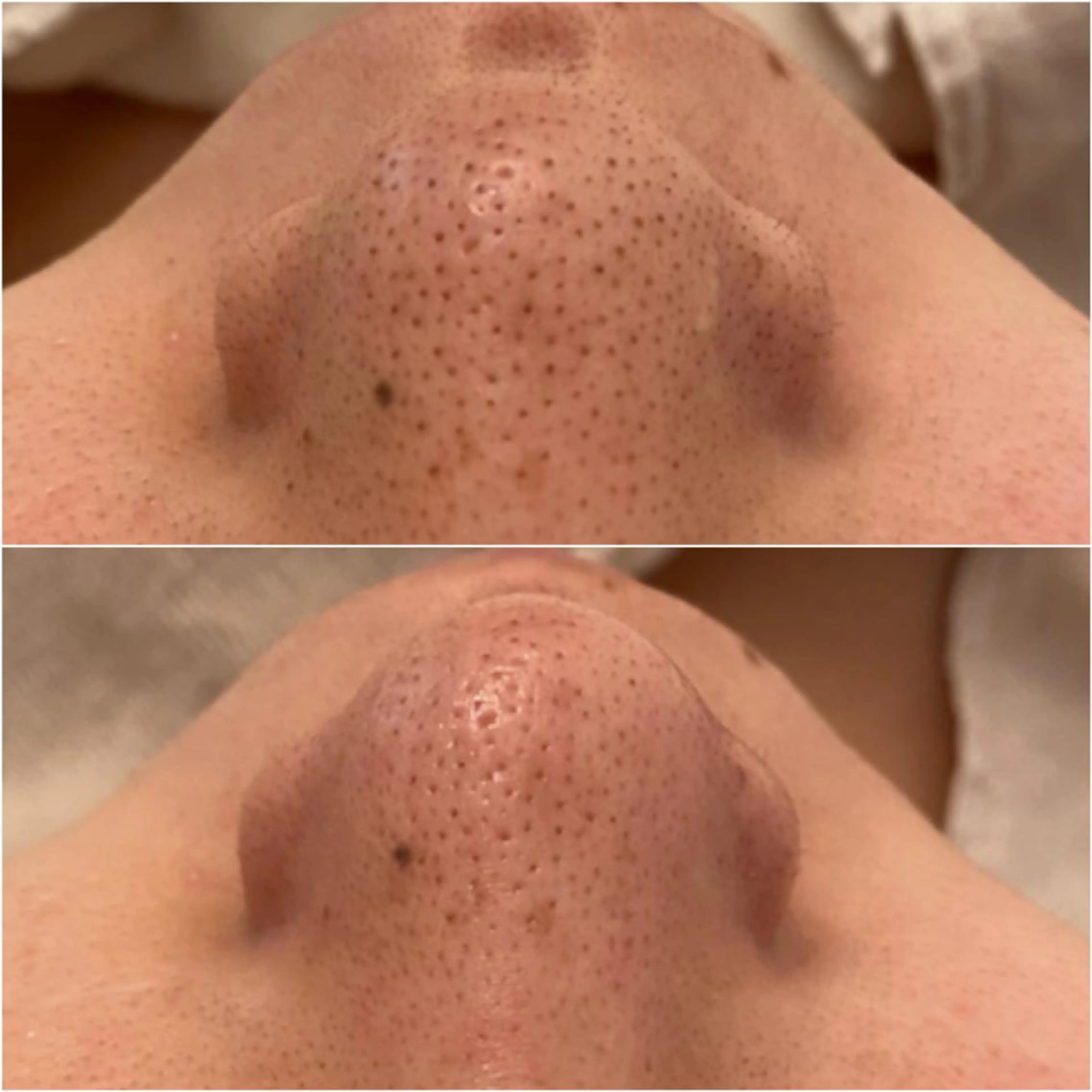 エステ ✨美肌水光✨ アトリエリュバンのエステ・リラクイメージ