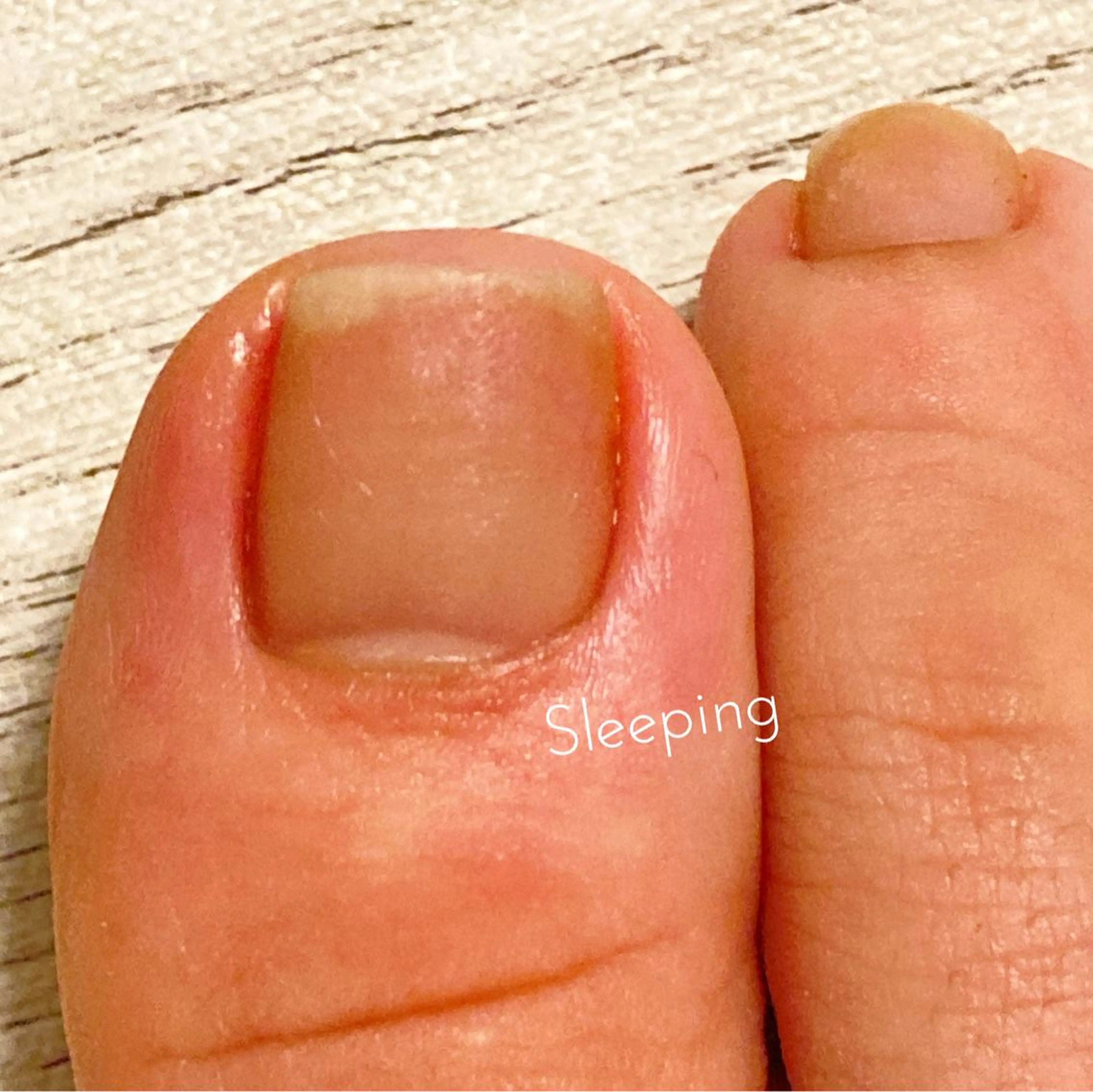 メンズ キッズ ネイル フットネイル フットネイル 🌱 ま し お 🌱のその他イメージ