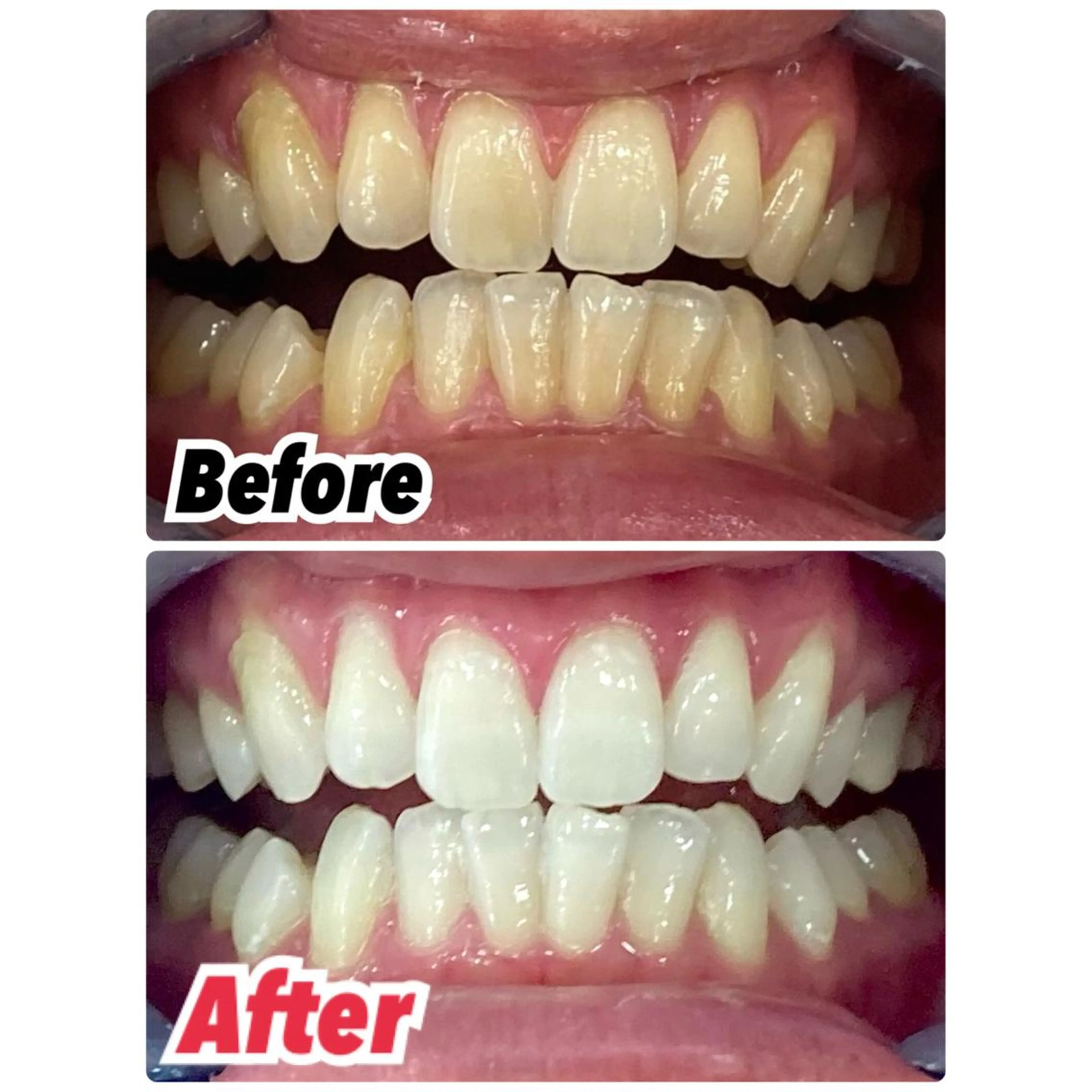 ヘアアレンジ メンズ プラチナムビューティー柏所属・【歯科提携】柏ホワイ トニングスタイルのその他イメージ