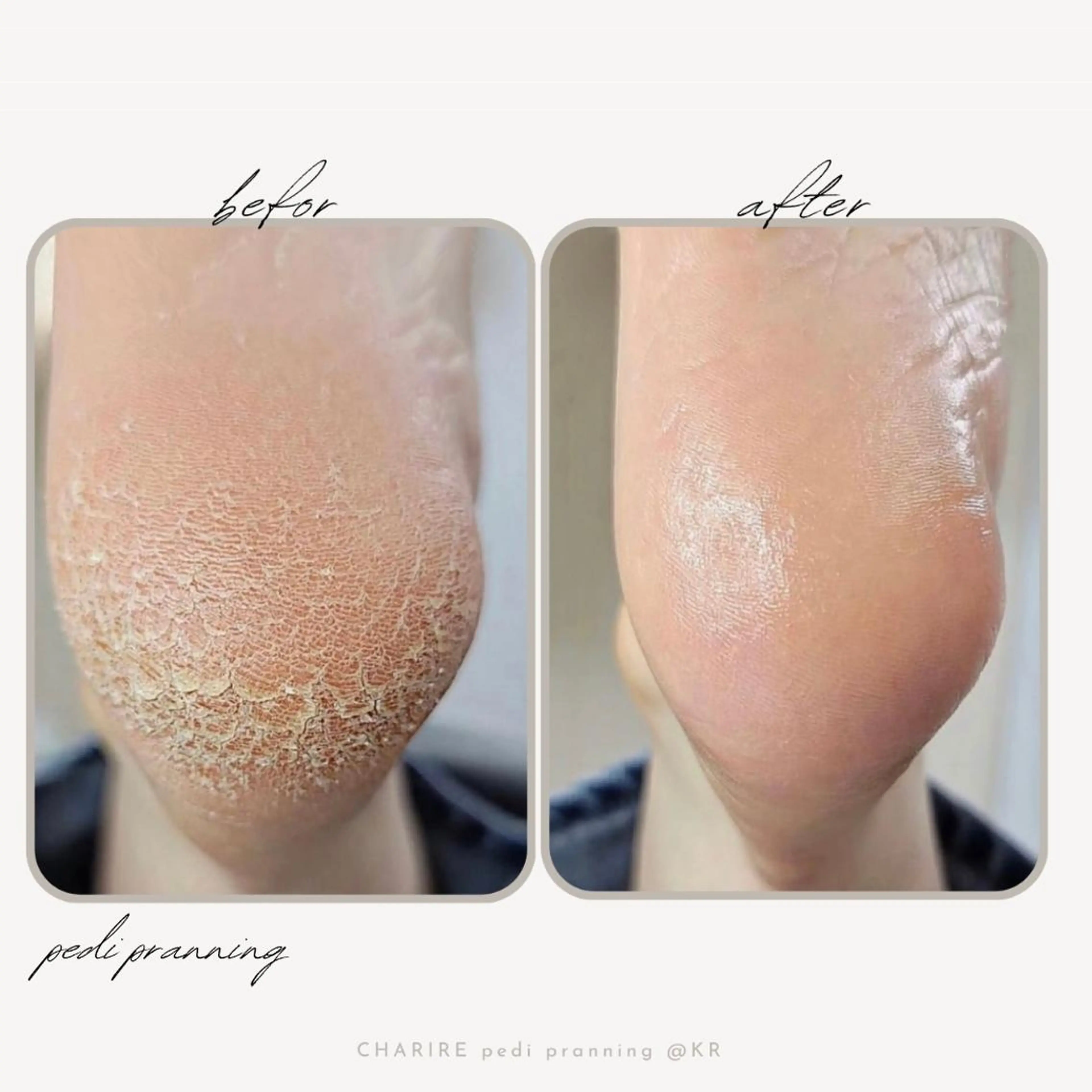 ネイル 韓国ネイル CHARIRE所属・CHARIRE chinatsuのマツエク・マツパデザイン