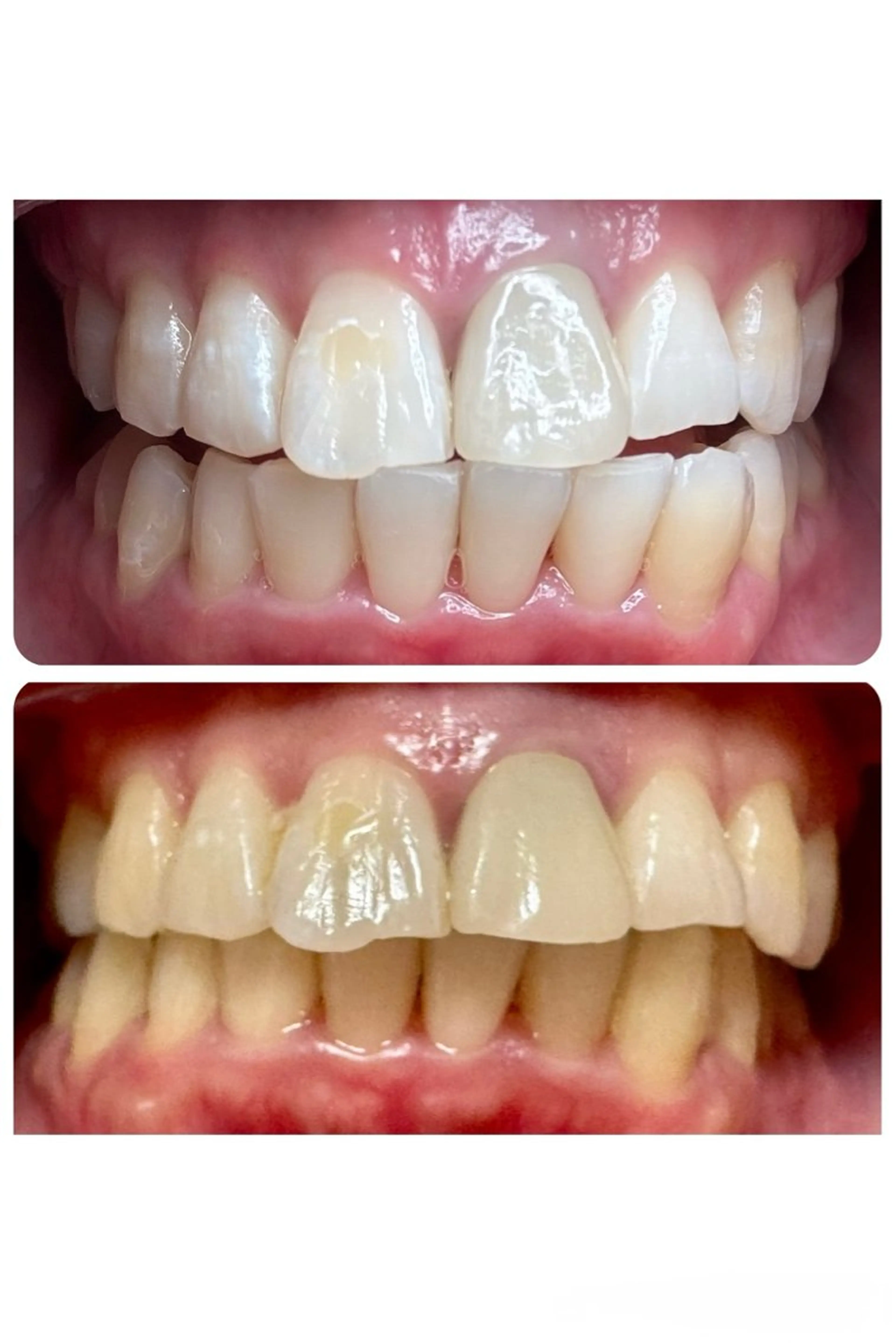 HAKU Aのその他イメージ