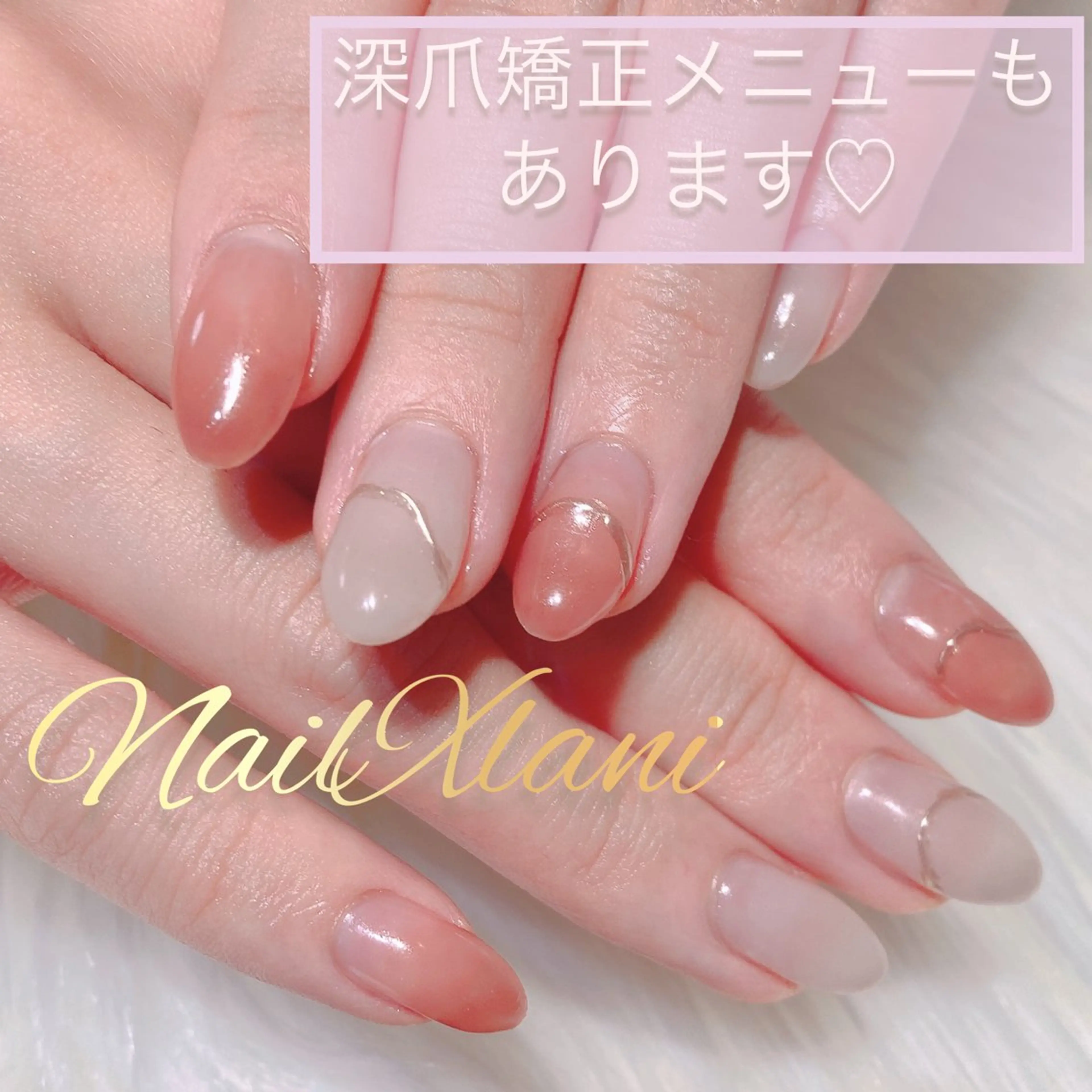 ネイル Nail×Lani 深爪矯正対応◎のネイルデザイン