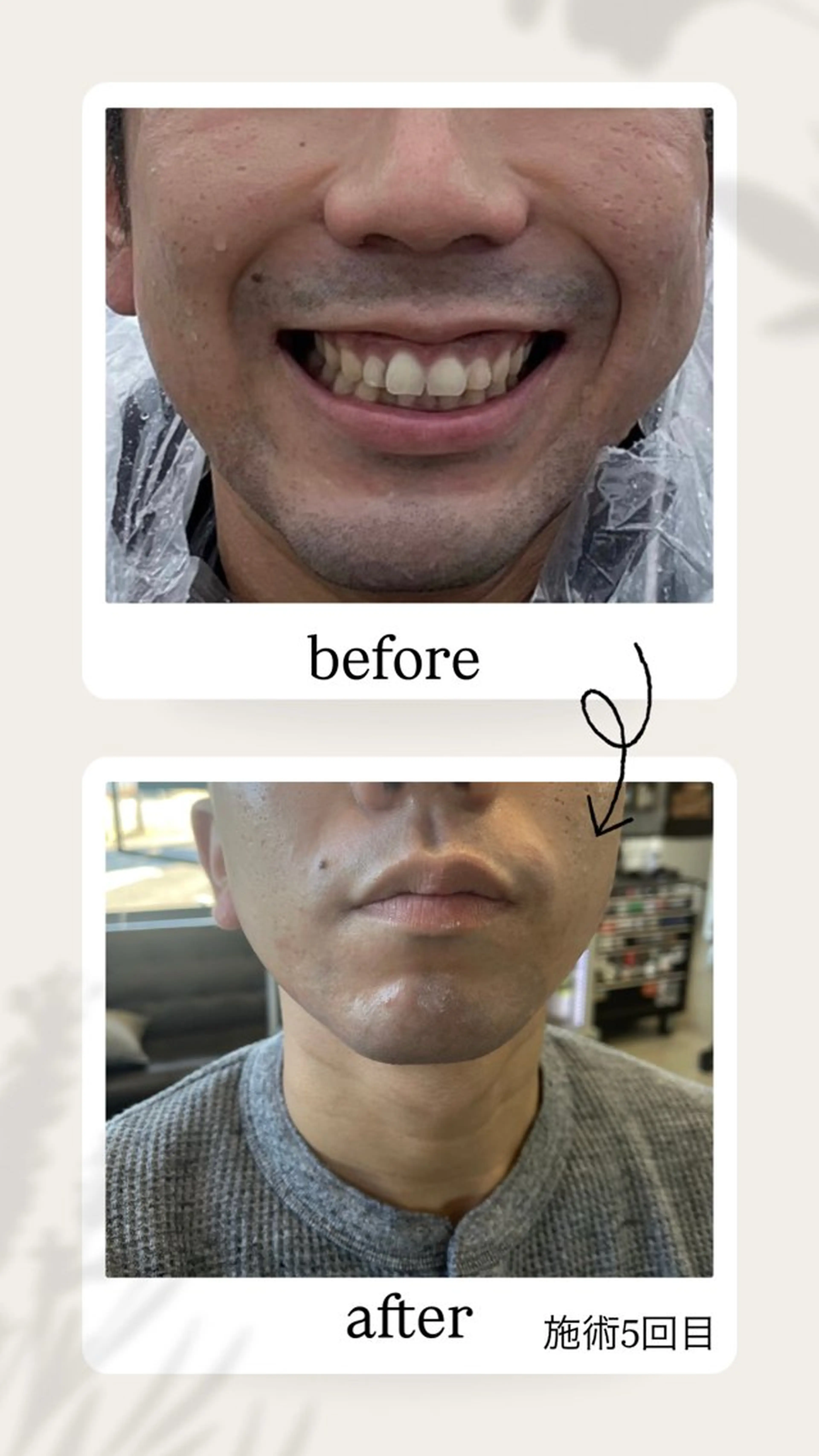 メンズ オトムスタ厶 カットクラブのエステ・リラクイメージ