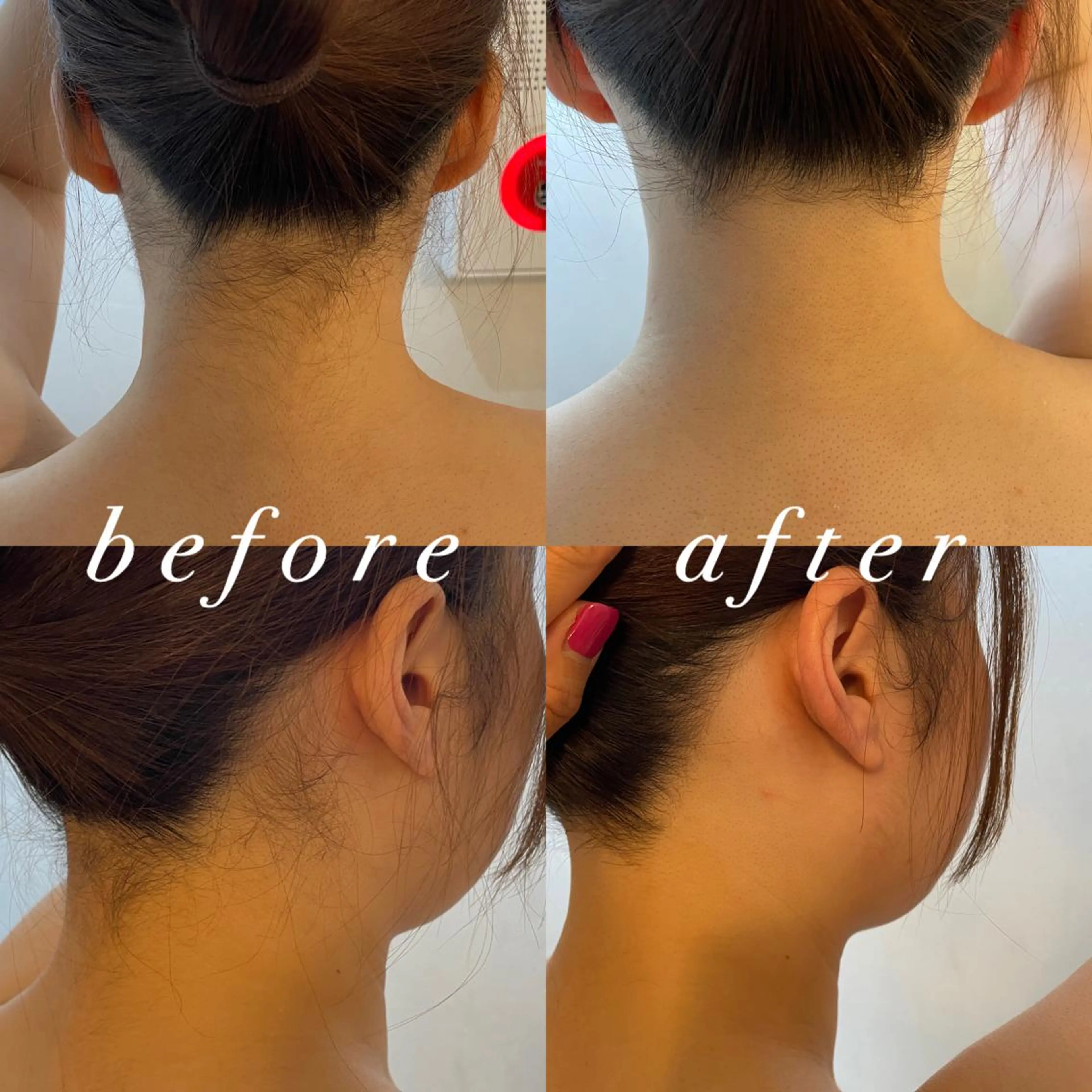 うなじ脱毛/美肌脱毛 LABELのエステ・リラクイメージ