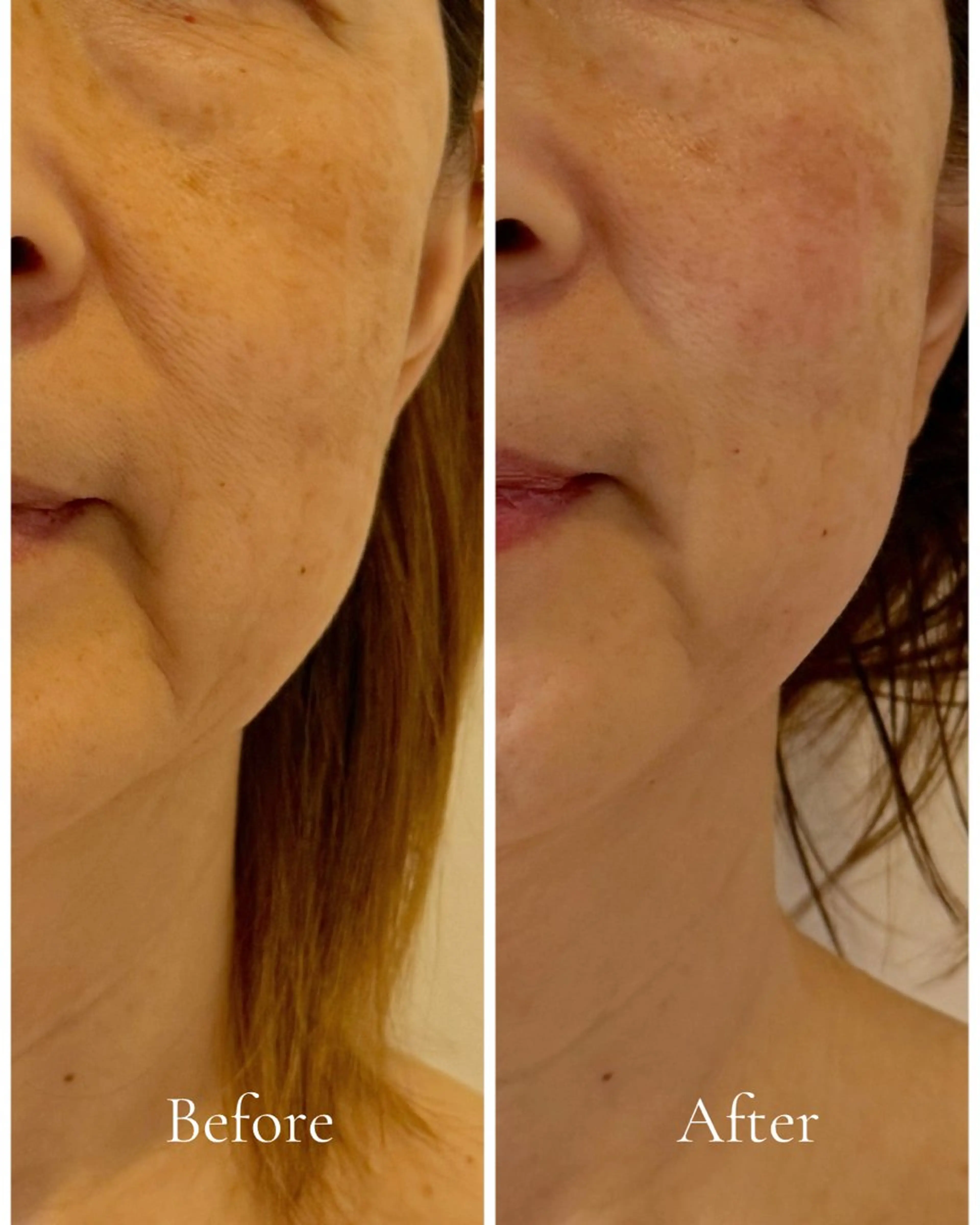 Lani Moon所属・⟡ 京都 小顔  ⊹ Lani Moonのエステ・リラクイメージ