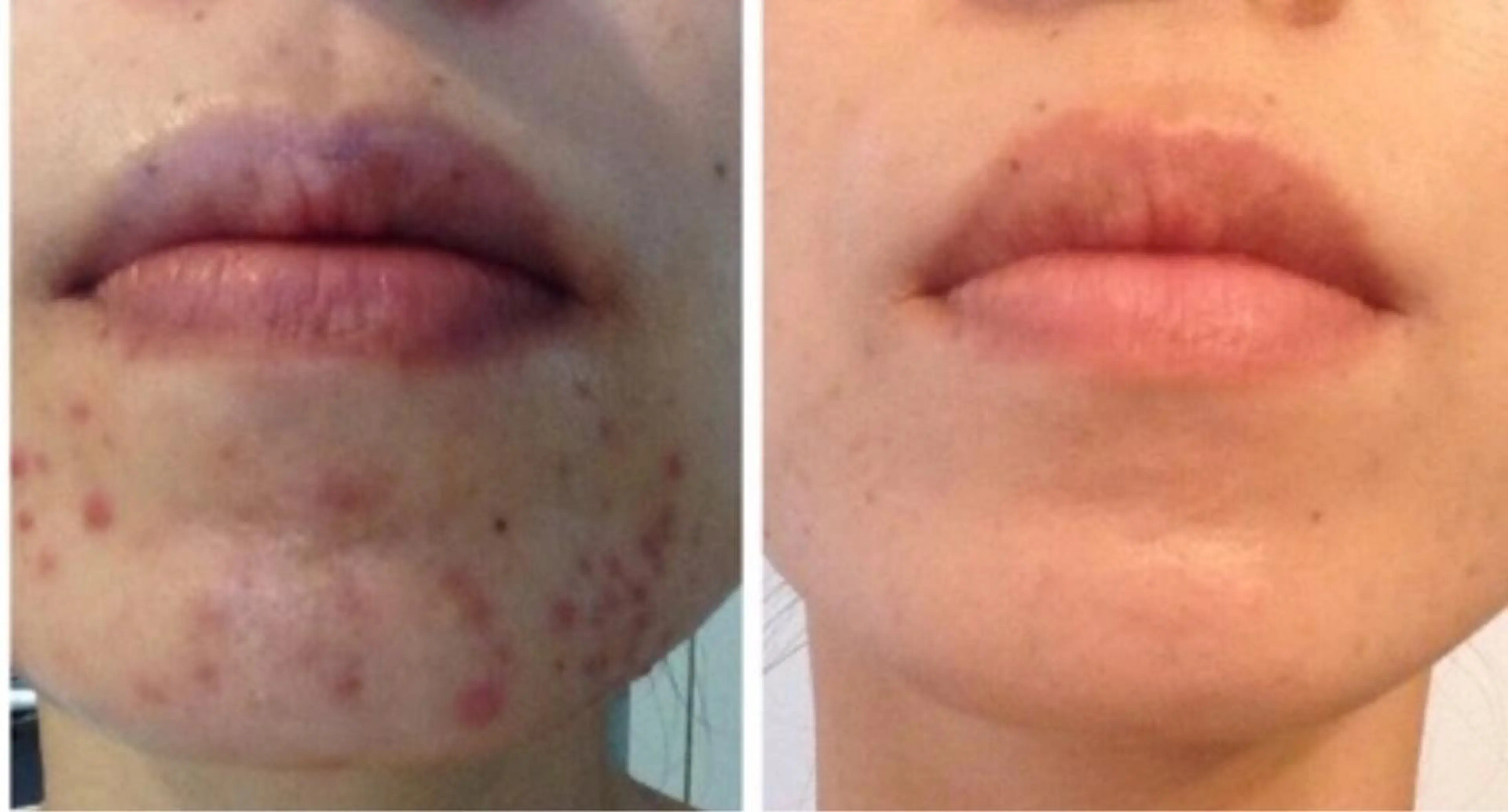 エステ リラク 🏳️‍🌈 CHIYAKAのエステ・リラクイメージ