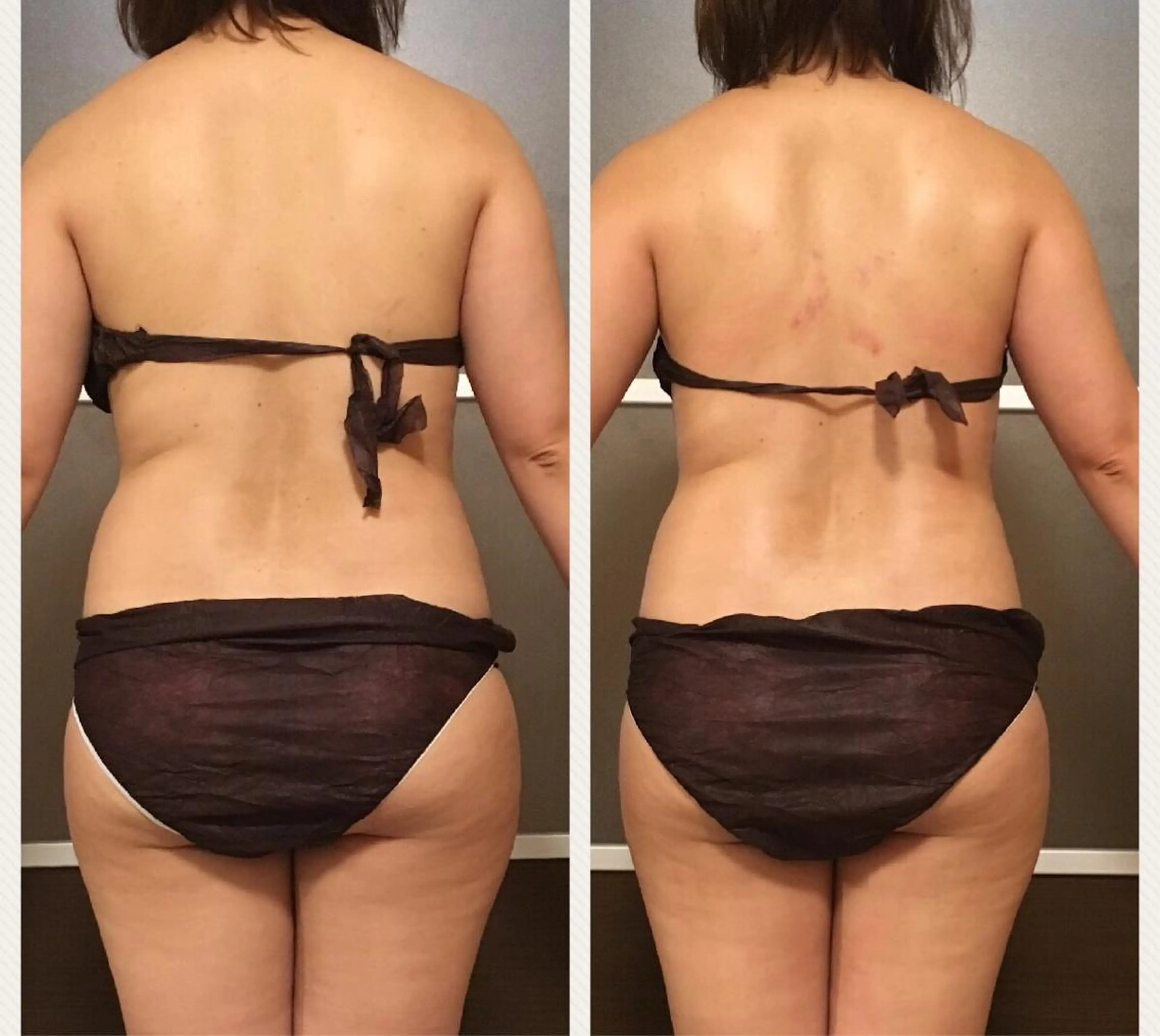 ミディアム カラー パーマ ヘアアレンジ メンズ キッズ ネイル マツエク・マツパ アニメ,Vオタク× 即効痩せエステサロンのエステ・リラクイメージ