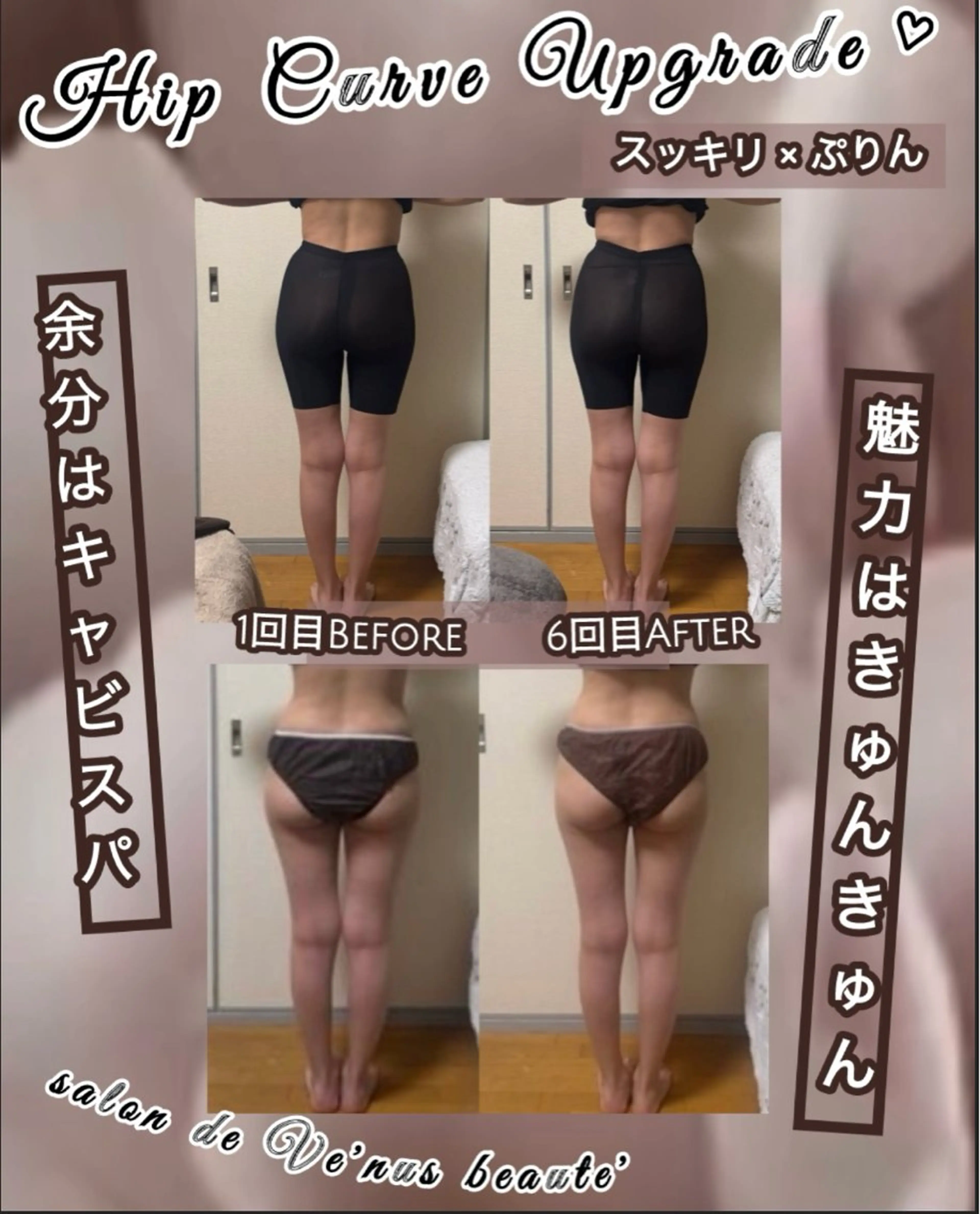 エステ ヴィーナス ビューティーのエステ・リラクイメージ