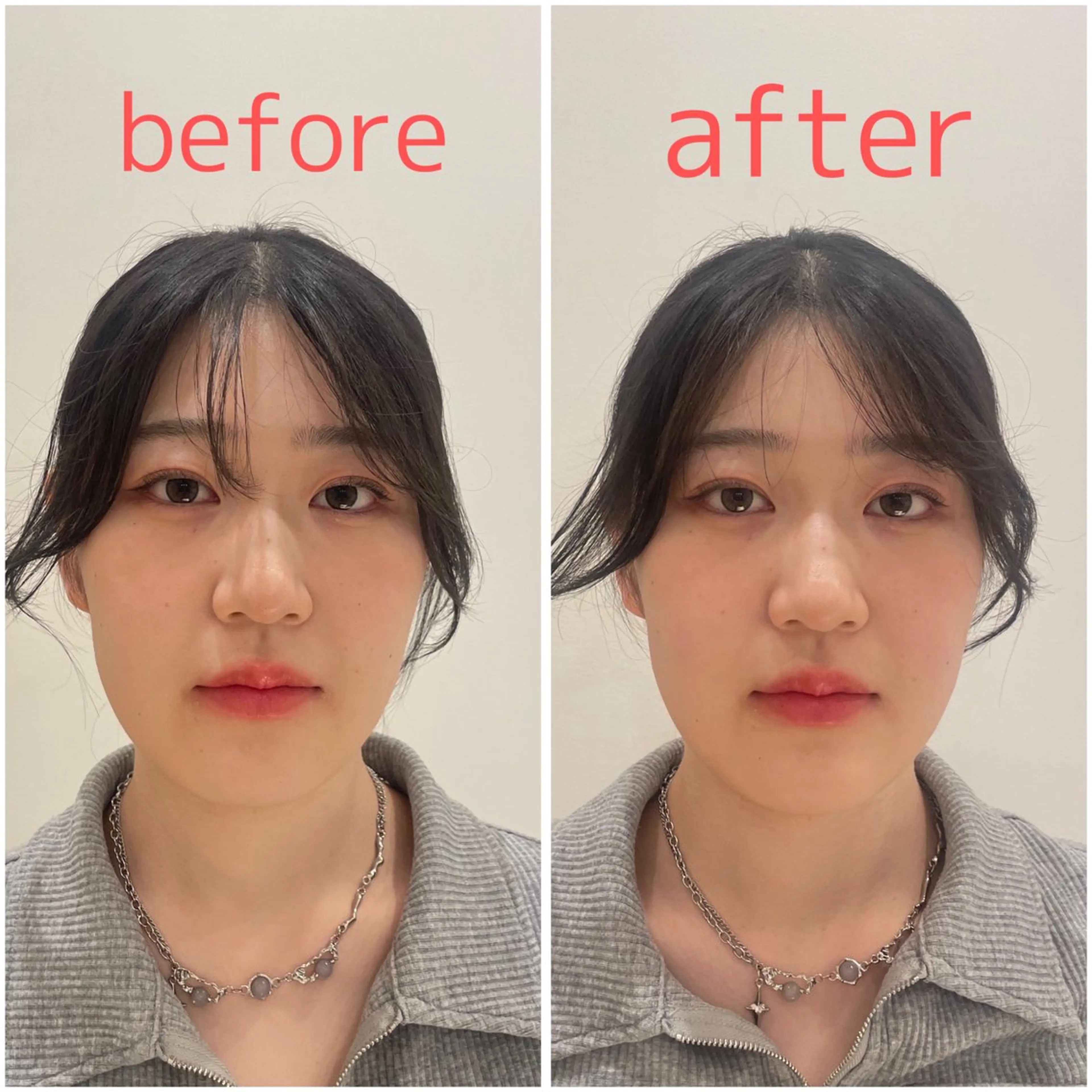 美容鍼サロンメゾンブランシェ所属・🌸美容鍼サロン🌸 メゾンブランシェ🌈のエステ・リラクイメージ