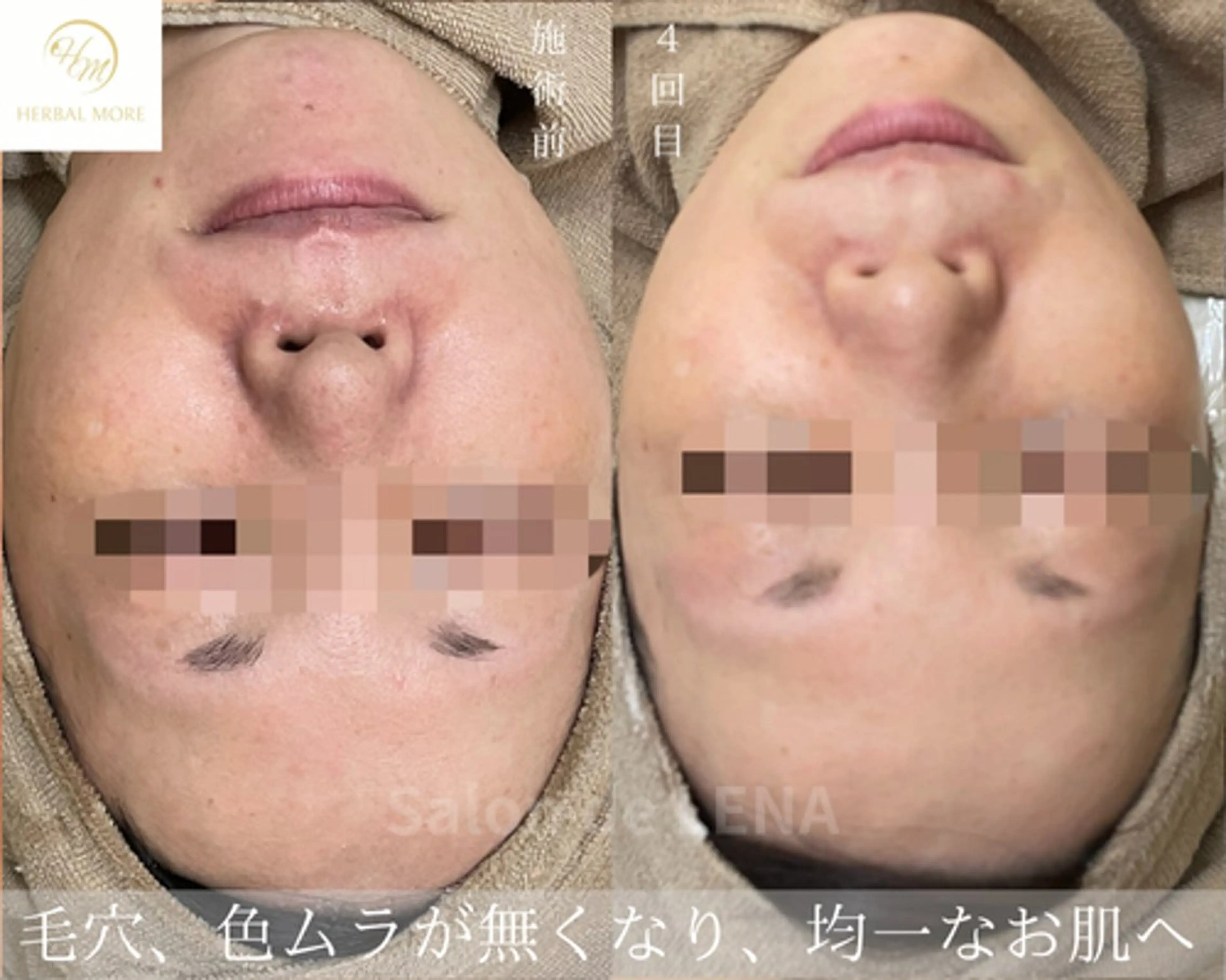 エステ サロンドレナ名駅店所属・ハーブピーリング専門 サロンドレナ平岡のエステ・リラクイメージ