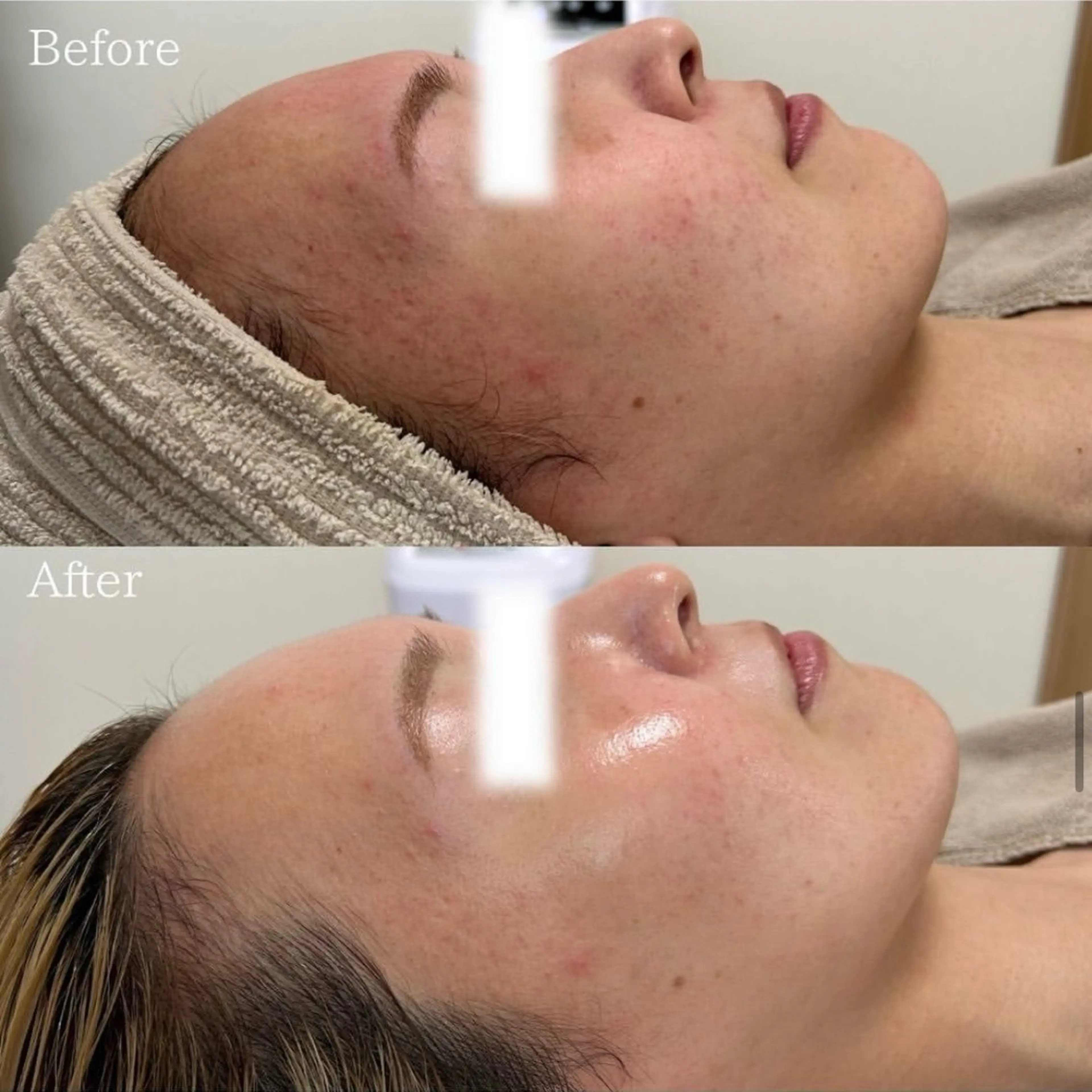 silo 結果重視の美肌サロンのエステ・リラクイメージ