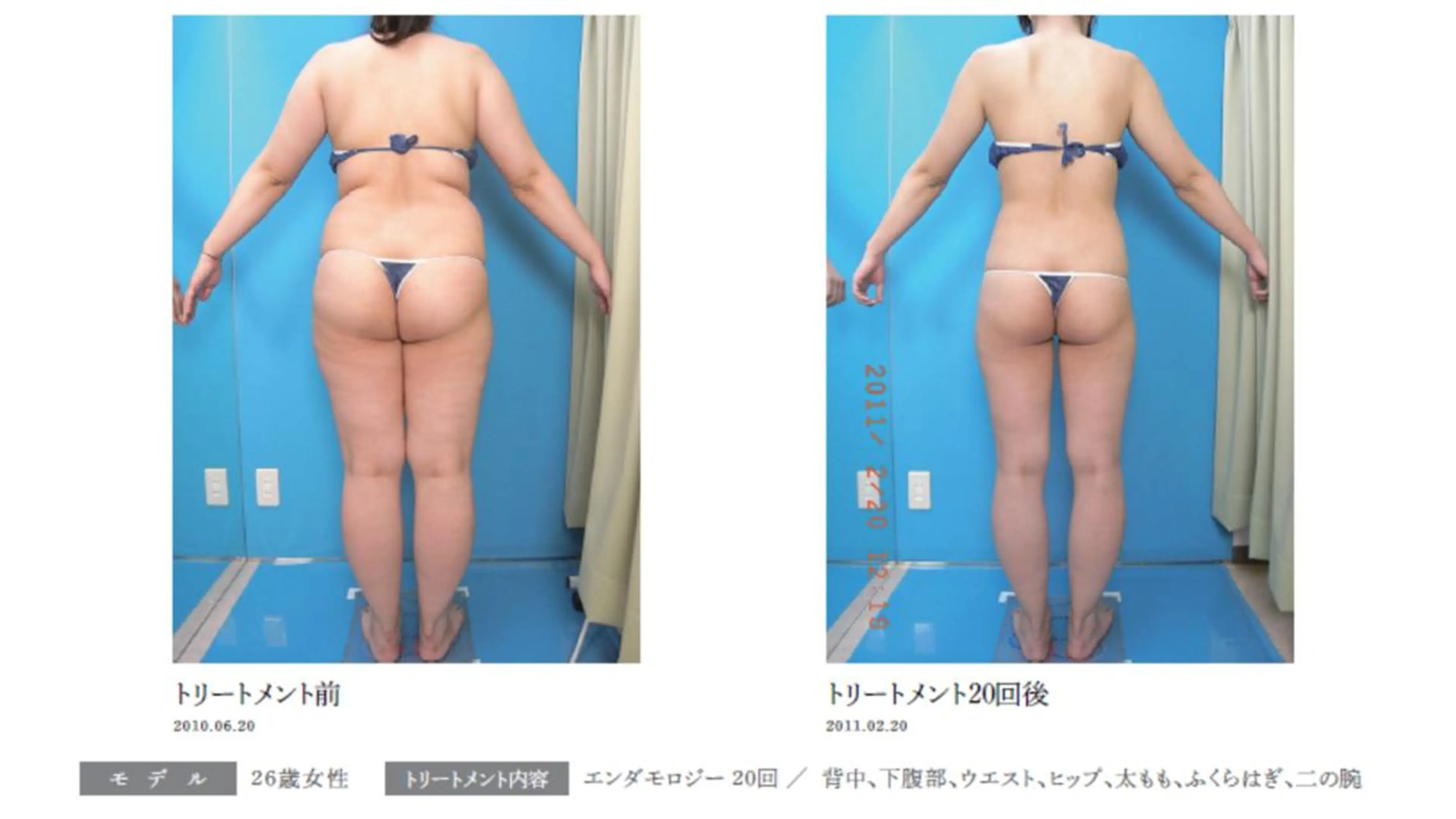 オレンジバナナ 新潟店のエステ・リラクイメージ