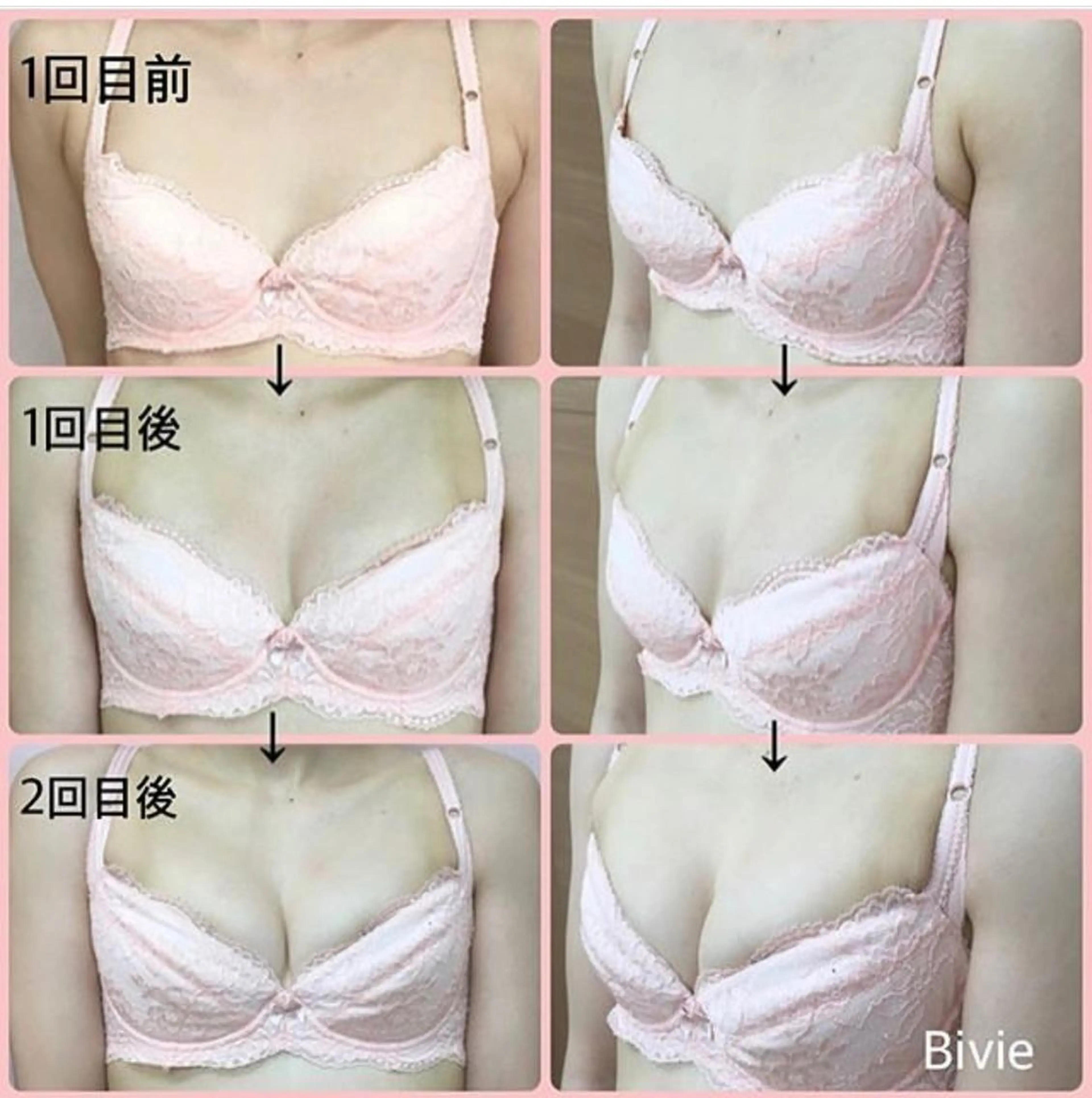 【バストケア】メニューはしっかりカウンセリングした後に当日決めたい方へ💖の写真