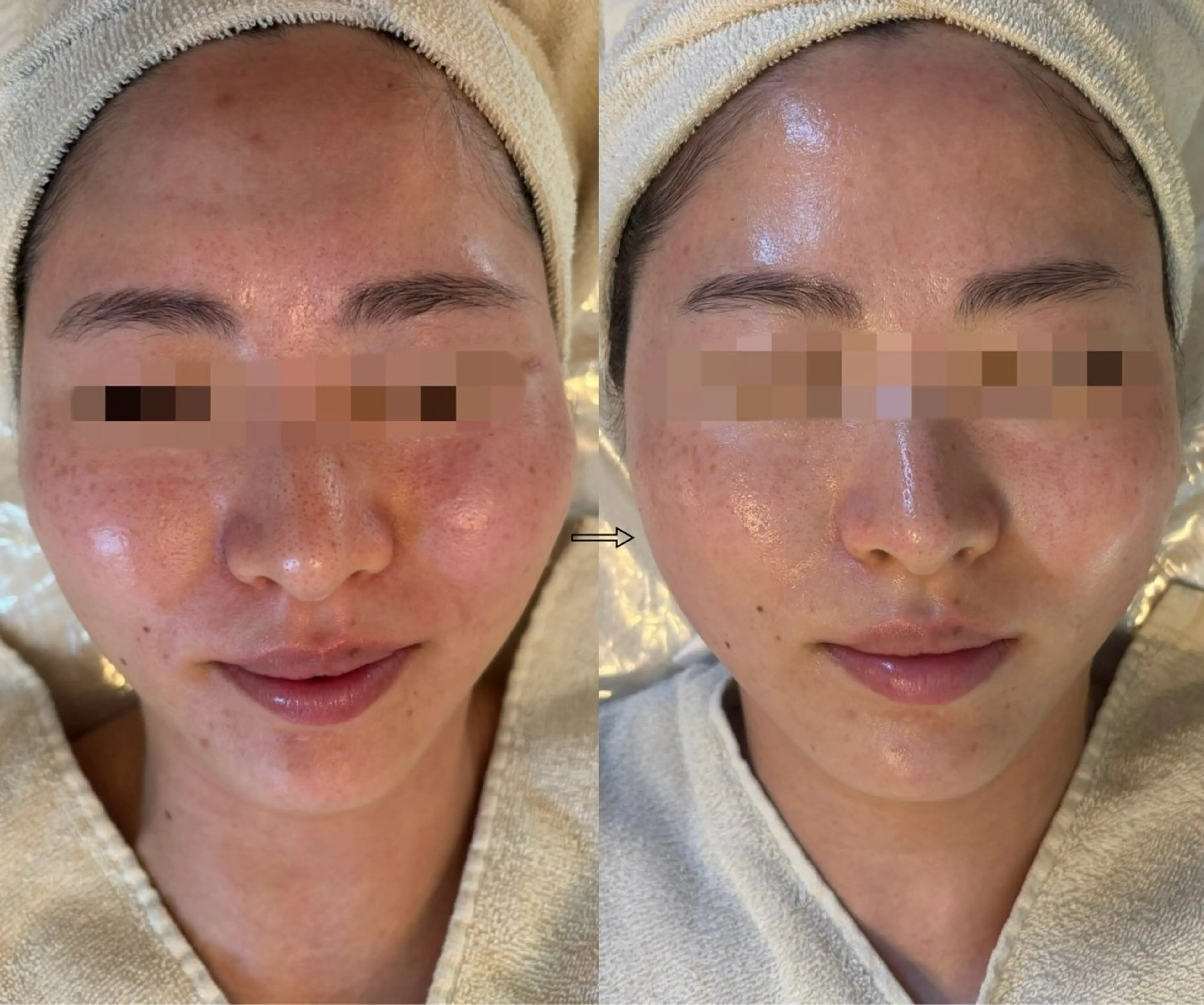 エステ anthes /MIHOのエステ・リラクイメージ