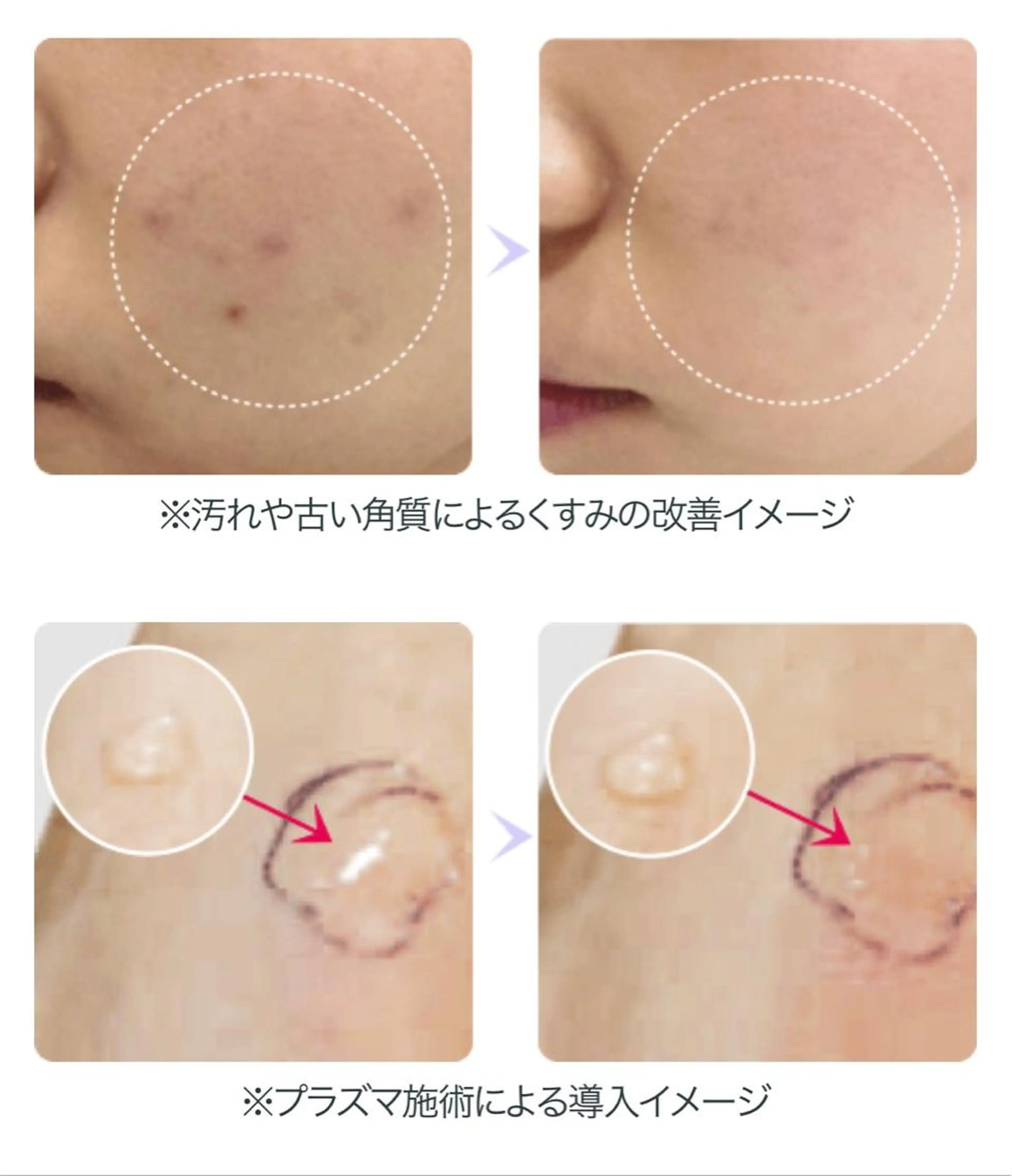 お肌の治安を守る👶プラズマシャワーの写真