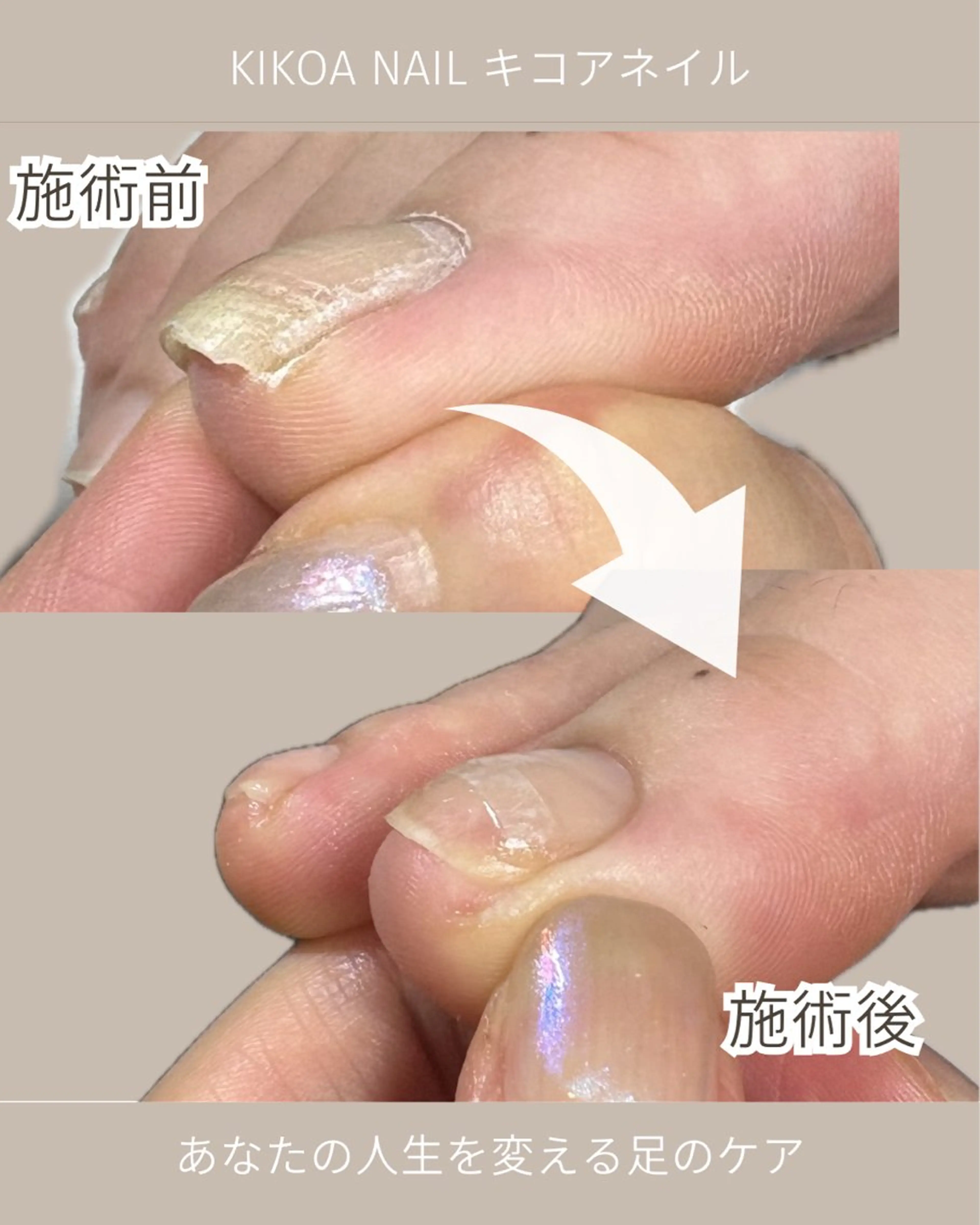 ネイル フットネイル KIKOA NAIL キコアネイルのネイルデザイン