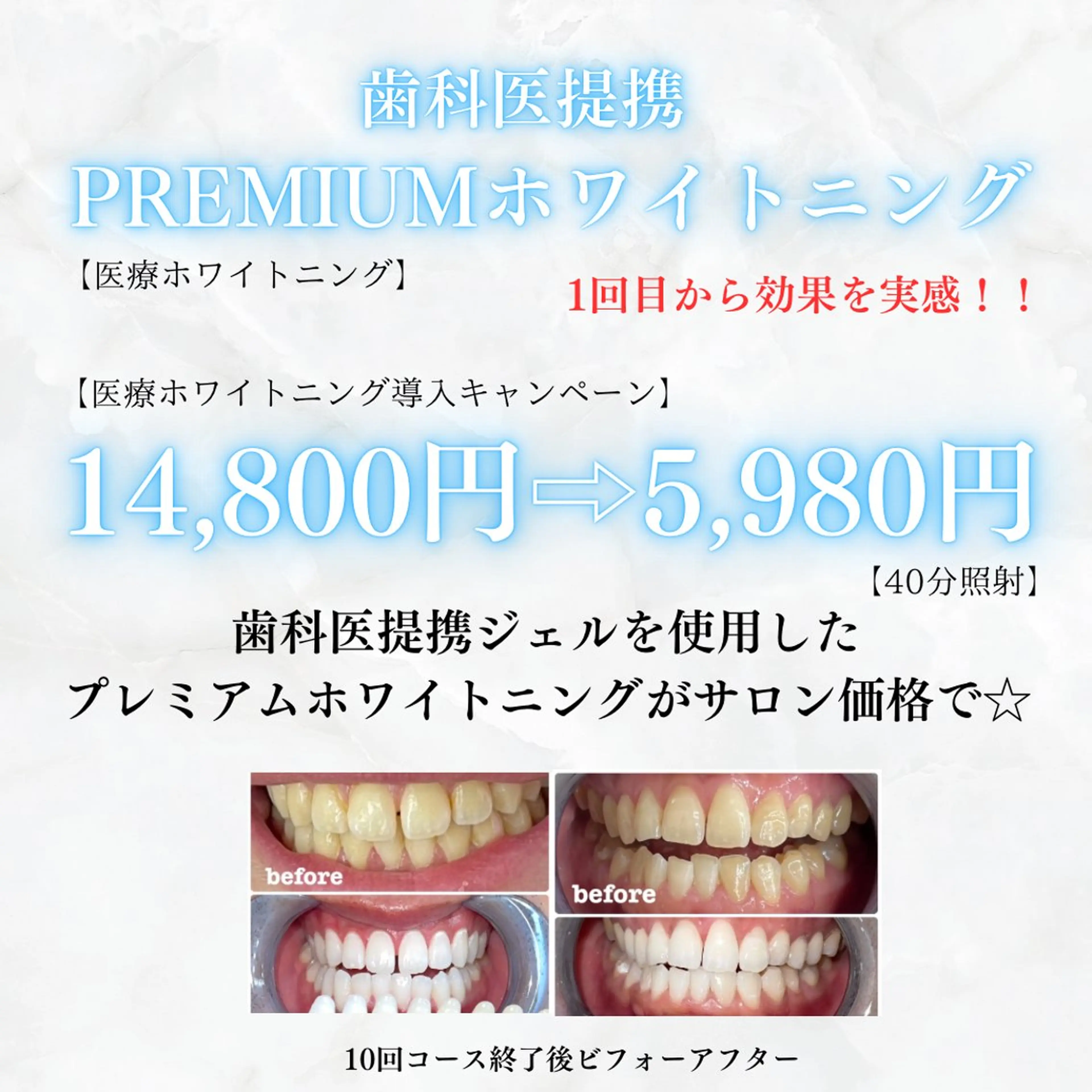 メンズ ホワイトニング専門店 WHITE天神店のエステ・リラクイメージ