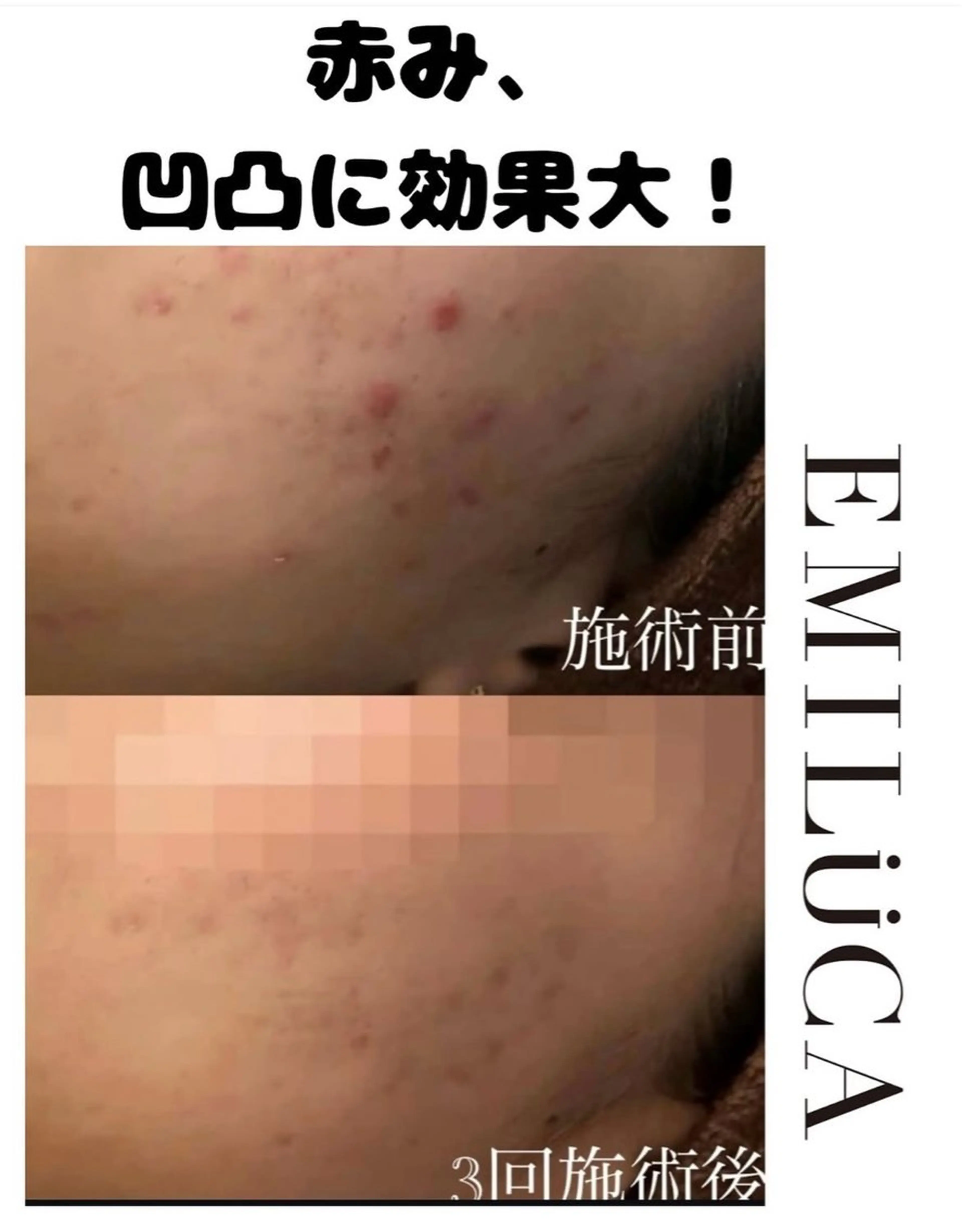 エミルカ 自由が丘店所属・花島 悠のエステ・リラクイメージ