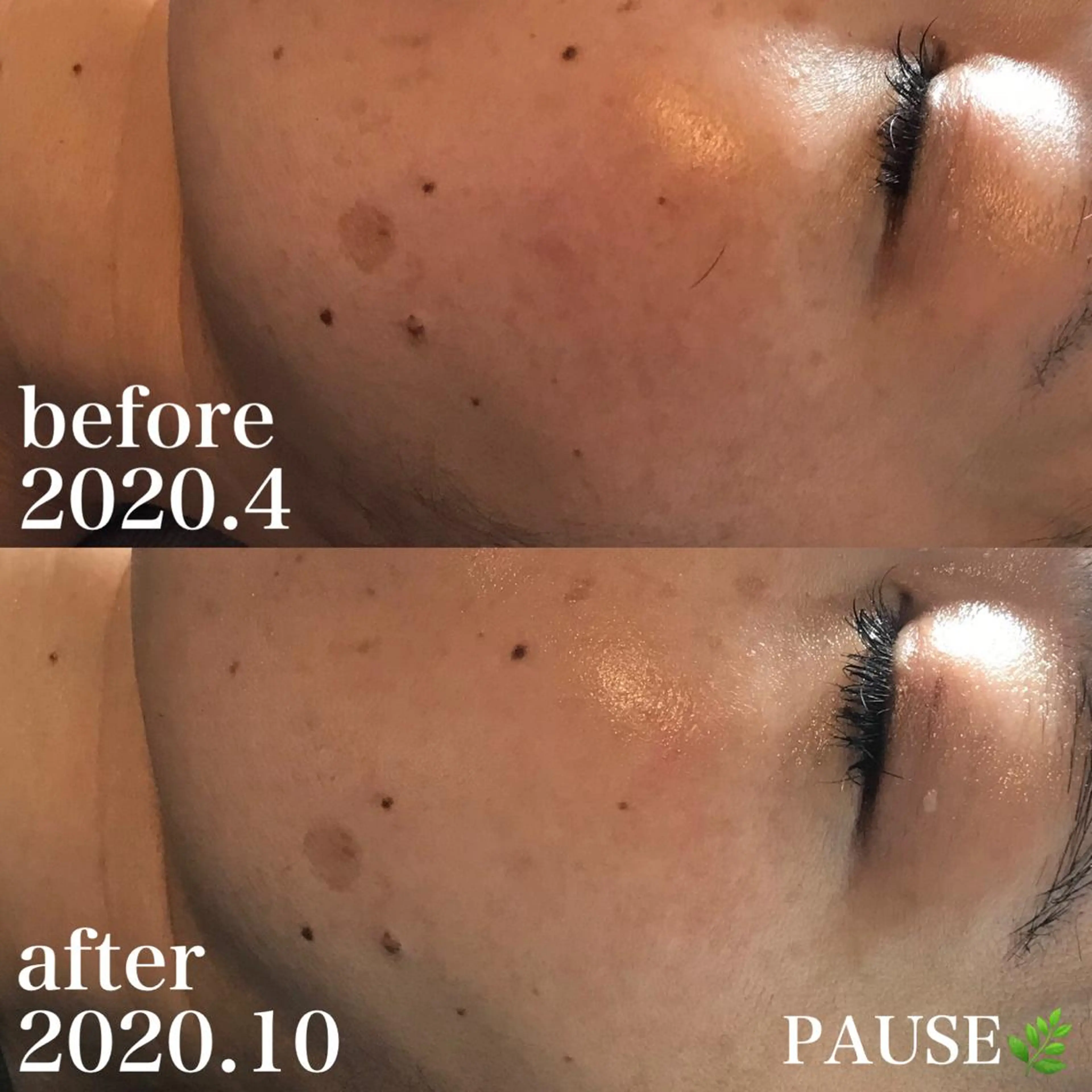 エステ 浜野 恵美のエステ・リラクイメージ