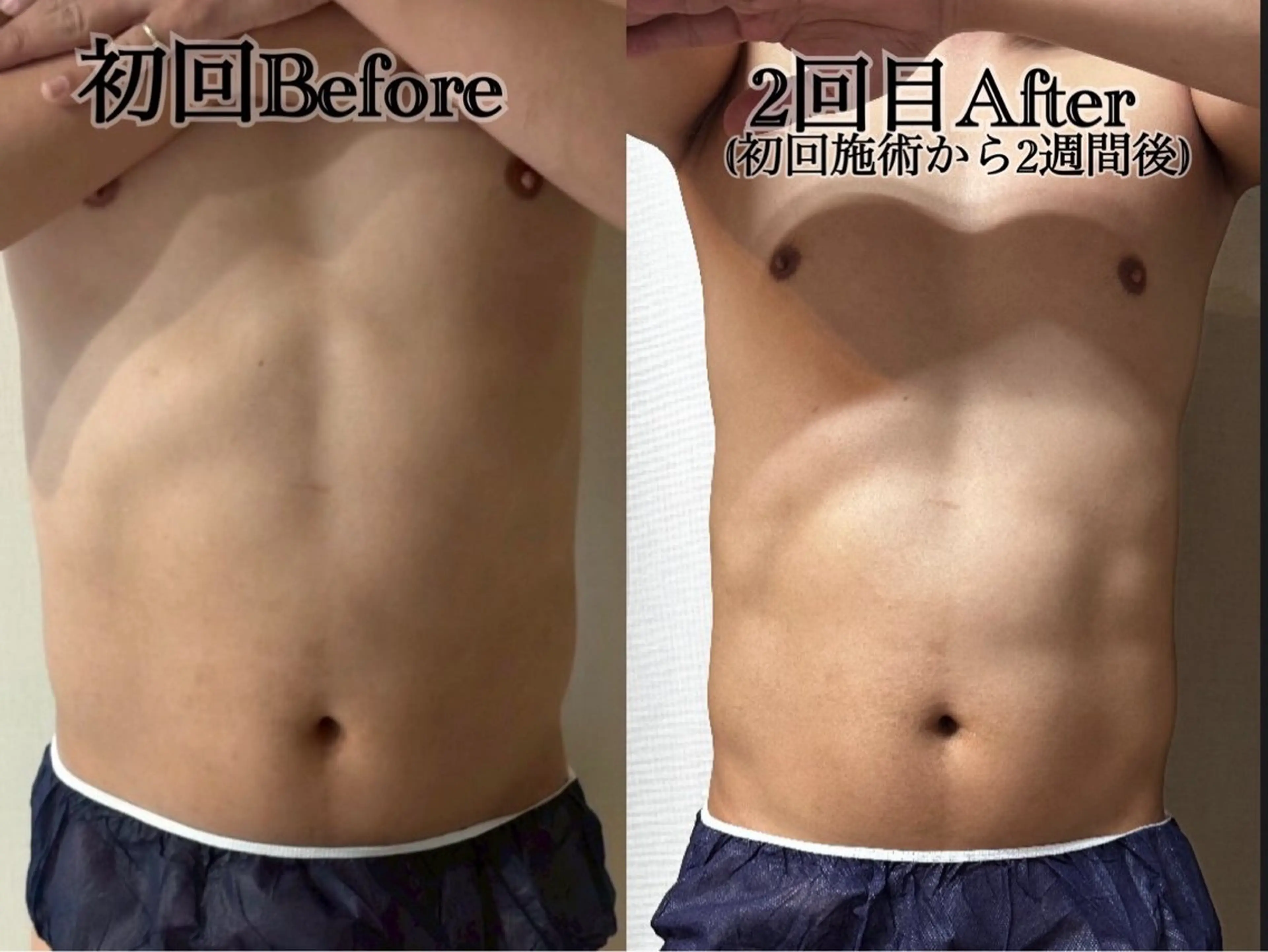 メンズ エステ 六本木/似合わせ眉毛 andＳ🍀Yuriのエステ・リラクイメージ