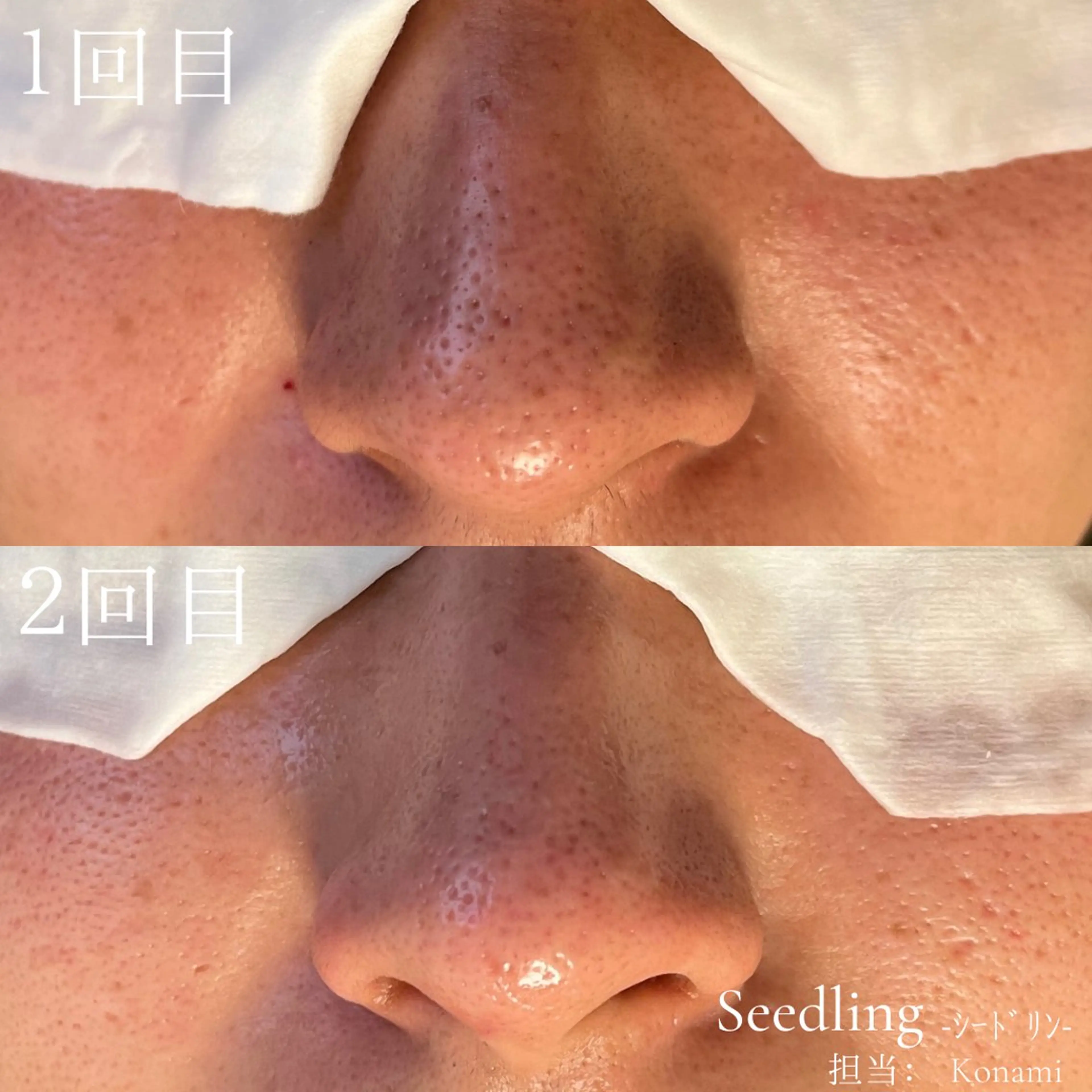 メンズ エステ シードリン 府内店 小波のエステ・リラクイメージ