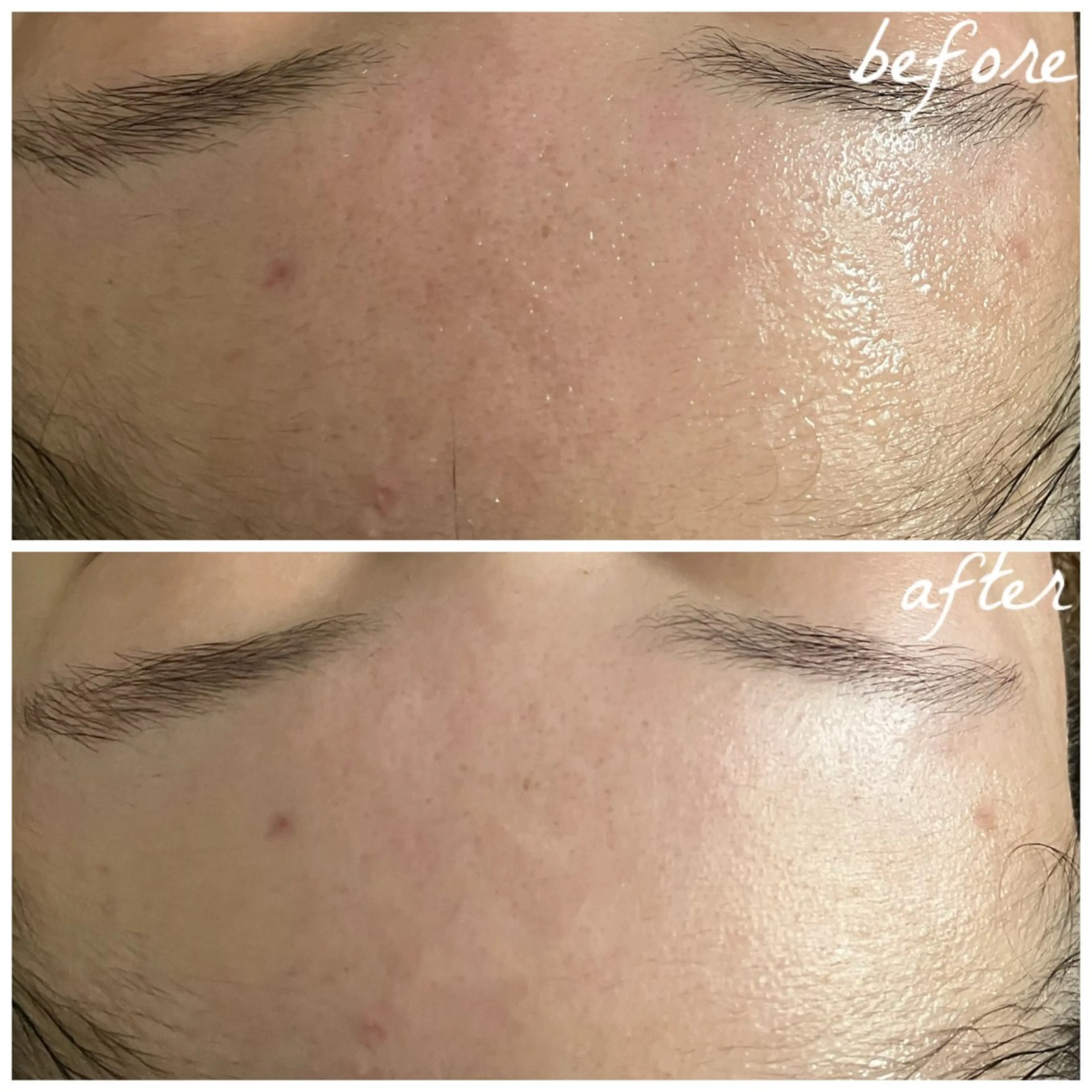 メンズ エステ メナード岐阜茜部 杉浦のエステ・リラクイメージ