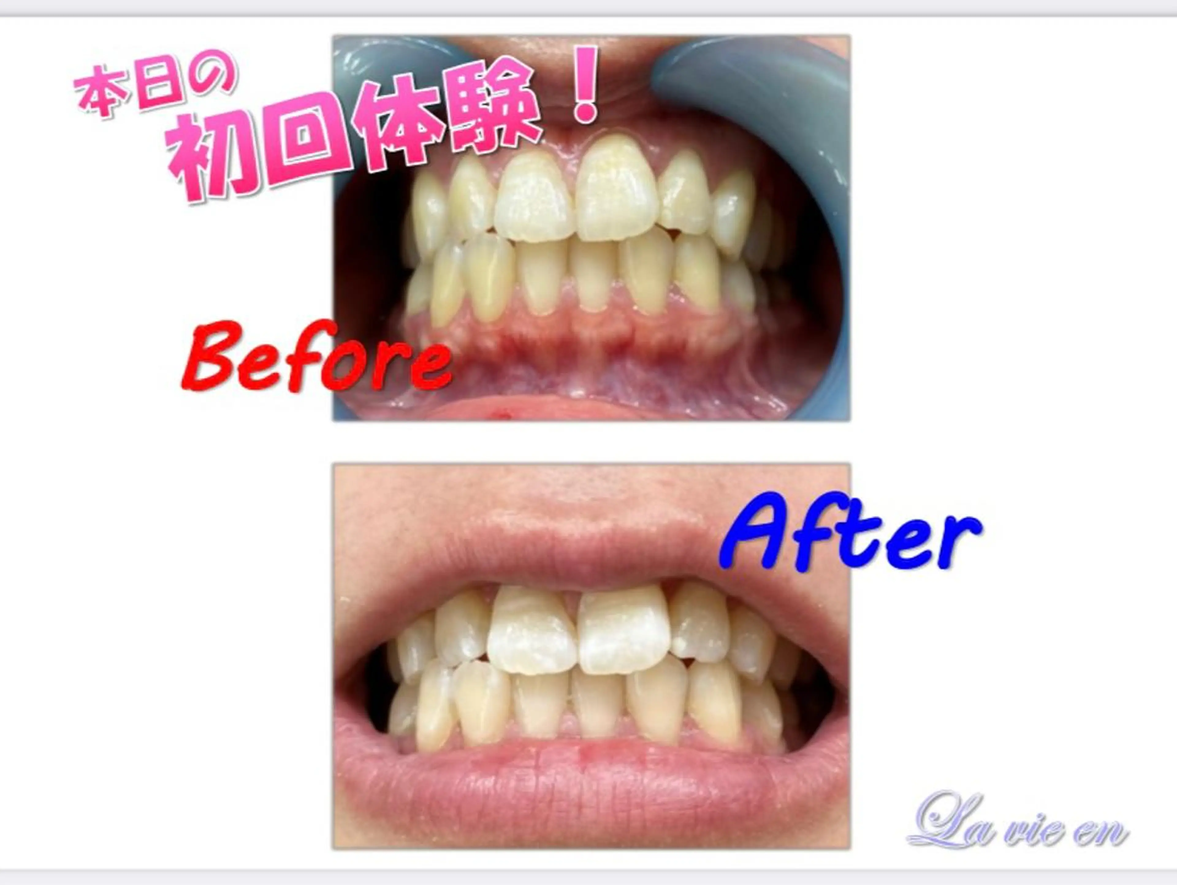 その他 セルフホワイトニングサロン　ラヴィアン所属・ホワイトニングサロン La vie enのその他イメージ