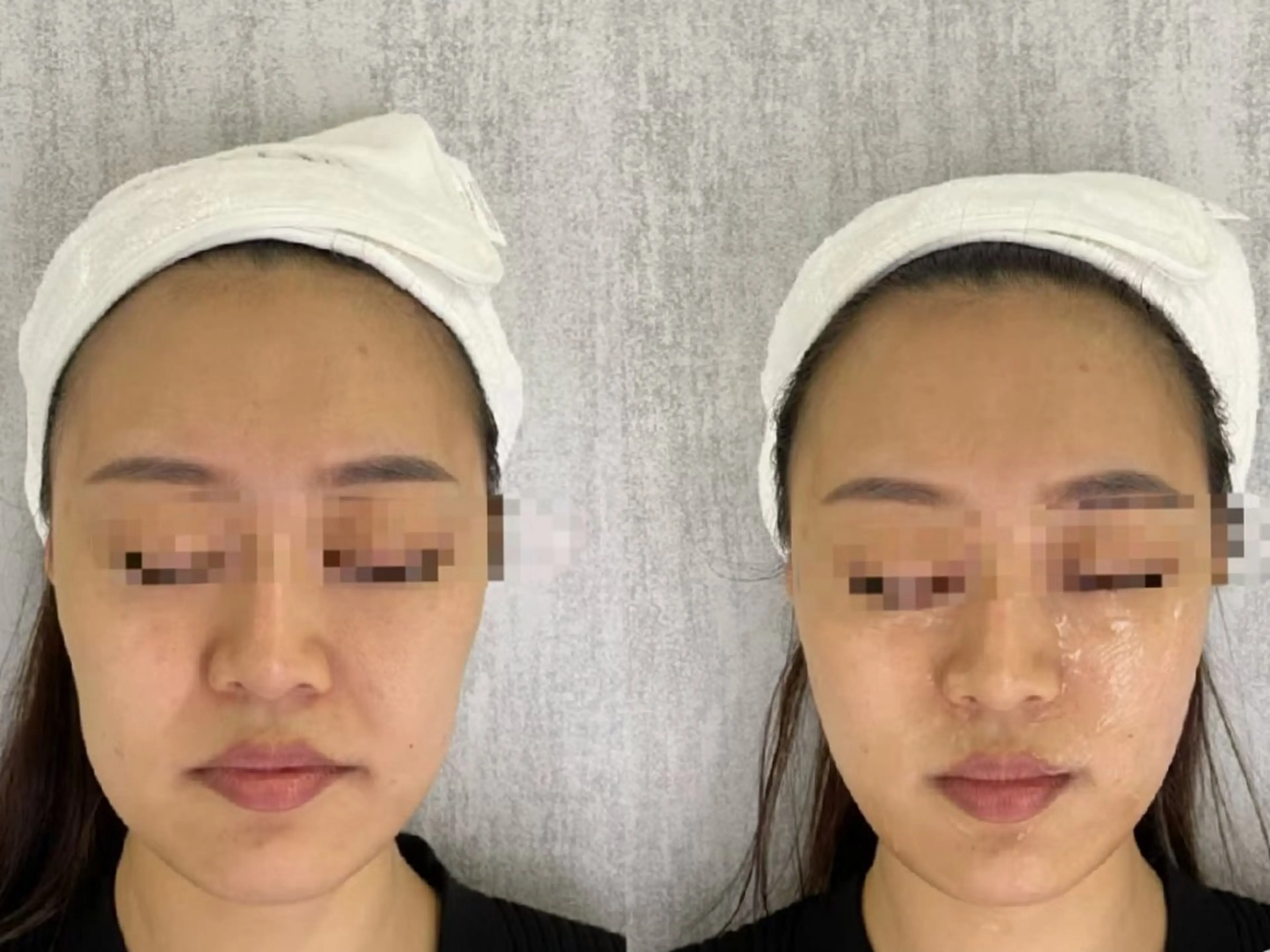 その他 aliaハイフ&水光ジェットサロン所属・aliaハーブ水光店 エステティシャン募集のエステ・リラクイメージ