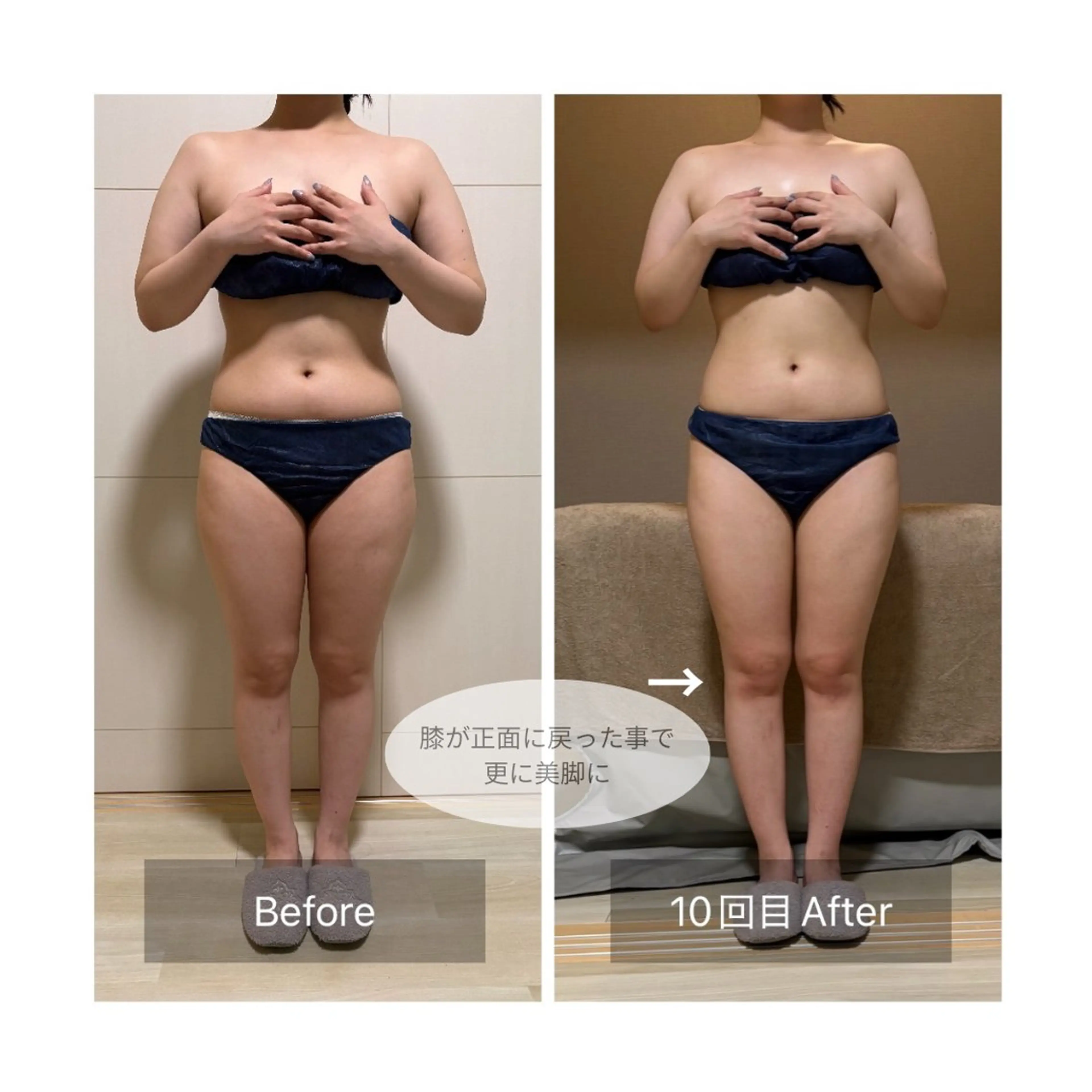 《仮予約》パワーレメディ45分｜上半身集中ケア｜首肩・背中の疲れ◎肩甲骨剥がしで美姿勢に◎ドレス映え狙う花嫁さんにも♪の写真