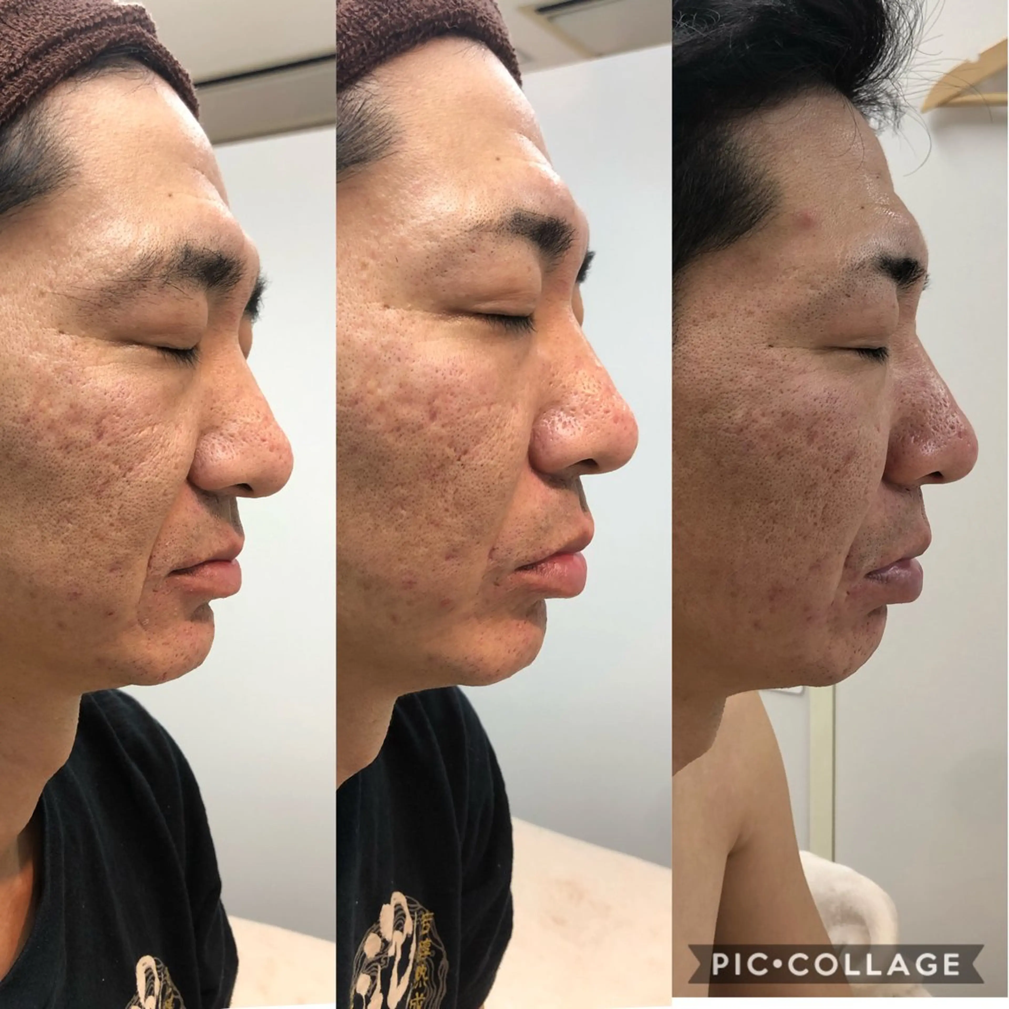 トータルビューティーサロン LilyRose所属・エステサロン LilyRoseのエステ・リラクイメージ