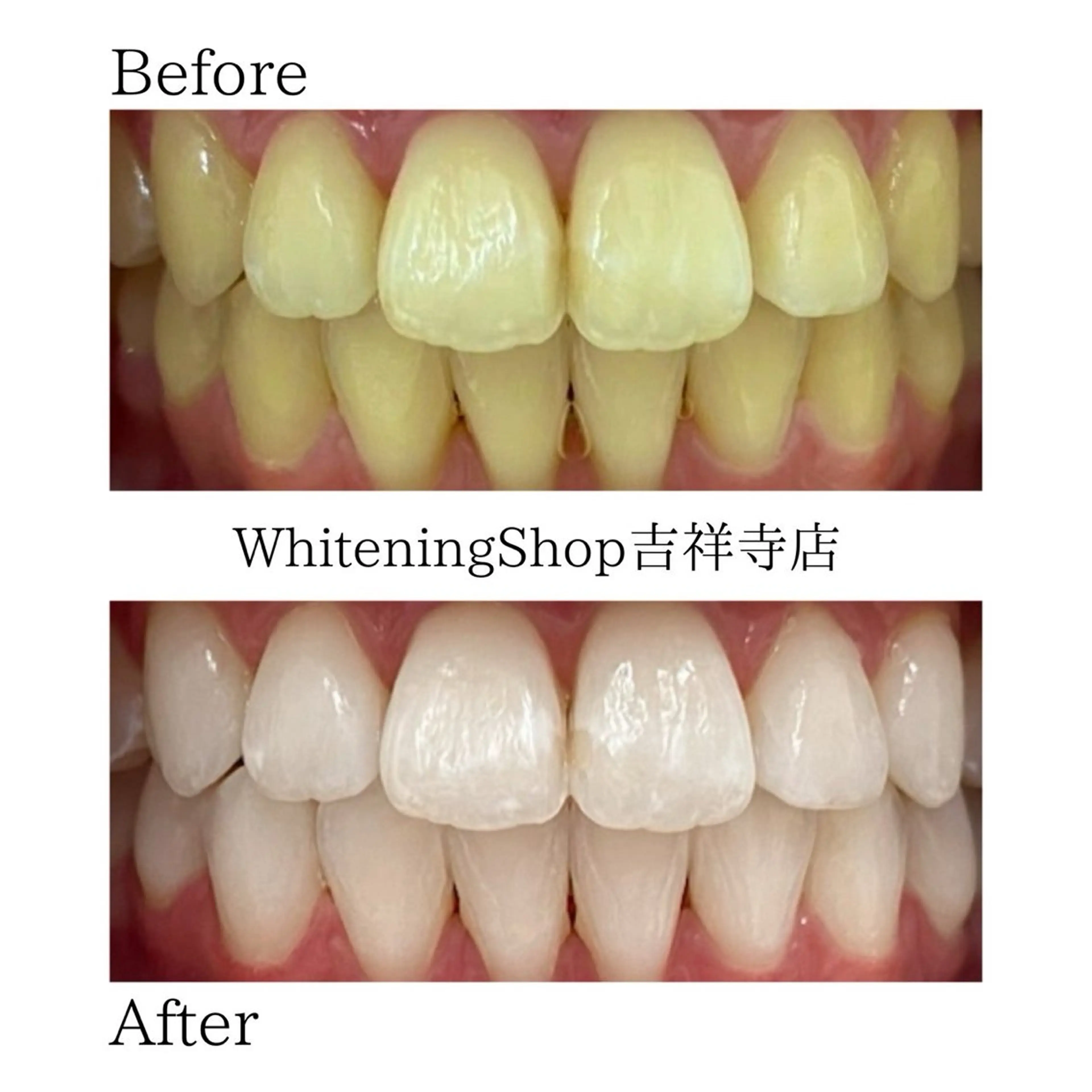 エステ リラク ホワイトニング ショップ吉祥寺店のエステ・リラクイメージ