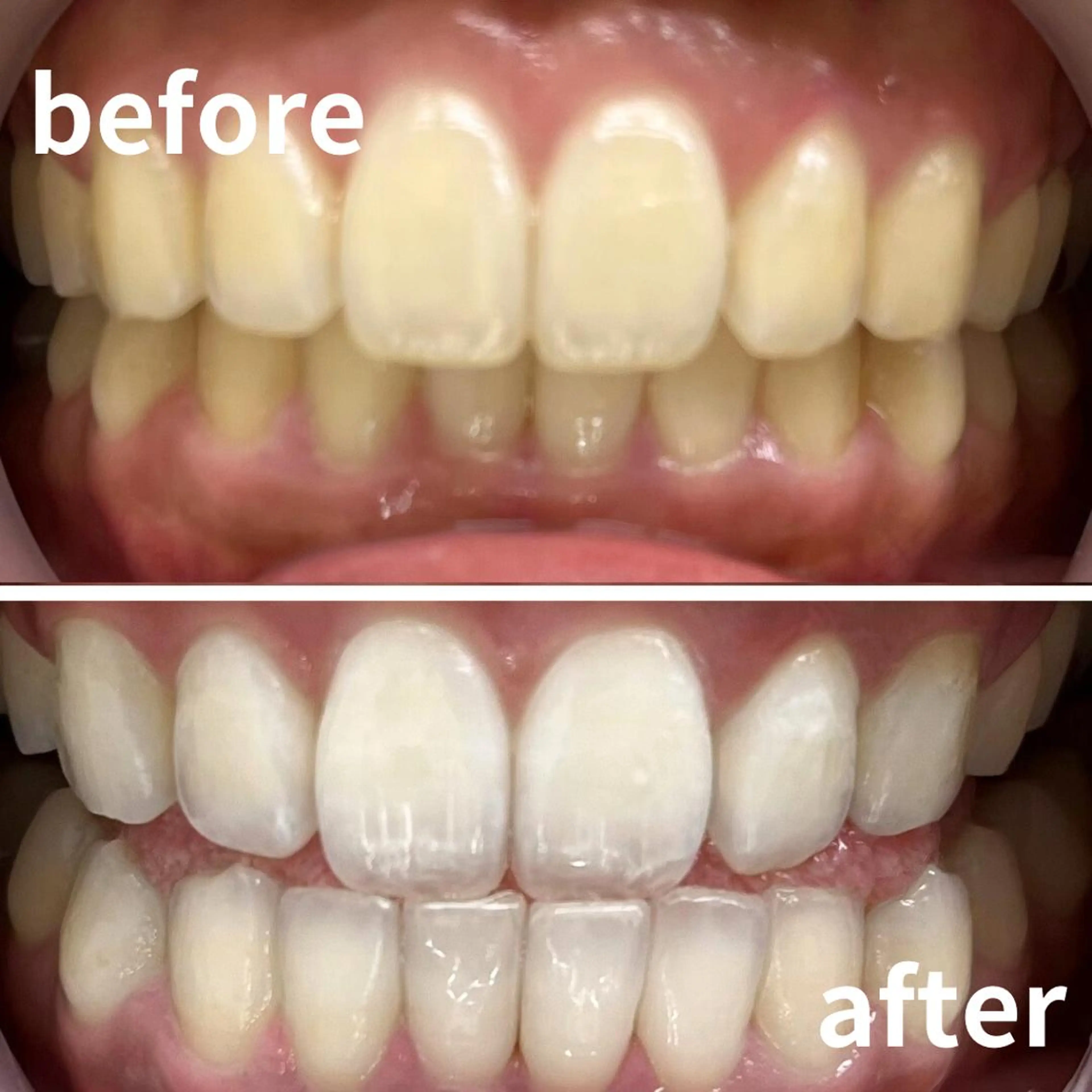 その他 LBSホワイトニング 銀座店💎スタッフ峯のその他イメージ