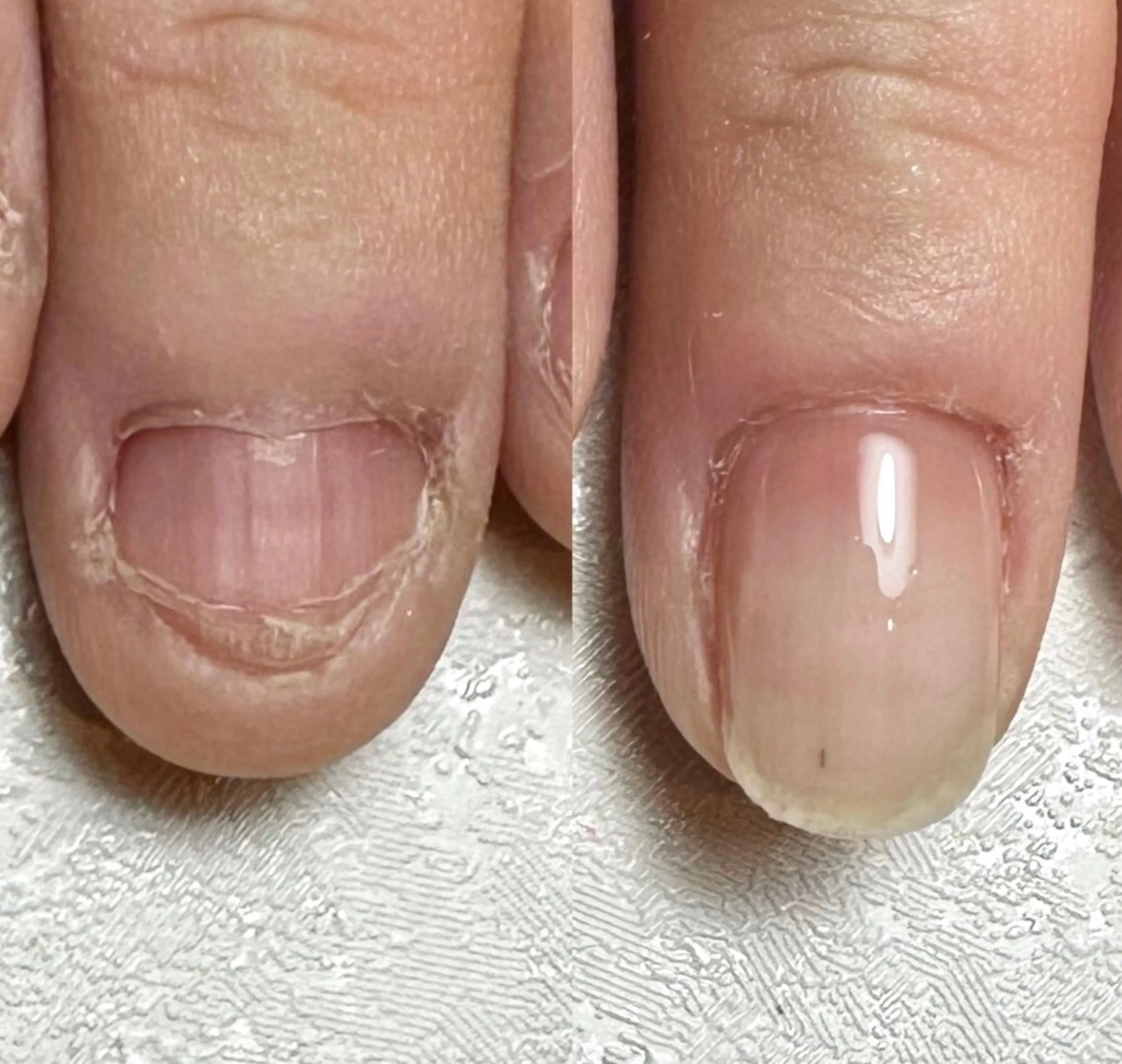 本気で変えたい方へ｜自爪育成　　　カウンセリング90分 ¥4,400の写真