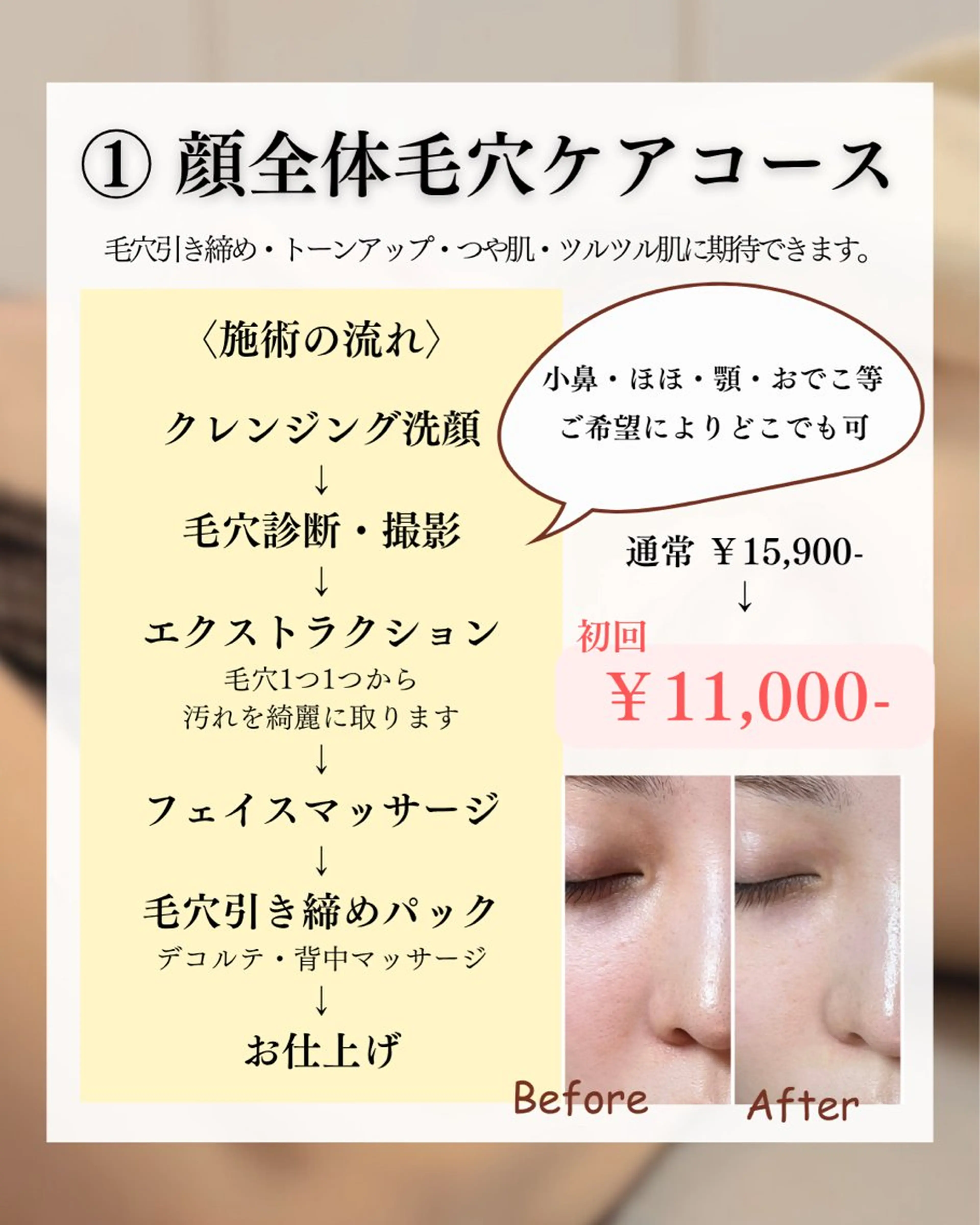 エステ リラク 結果重視｜毛穴エステ ｜友綱理恵のエステ・リラクイメージ