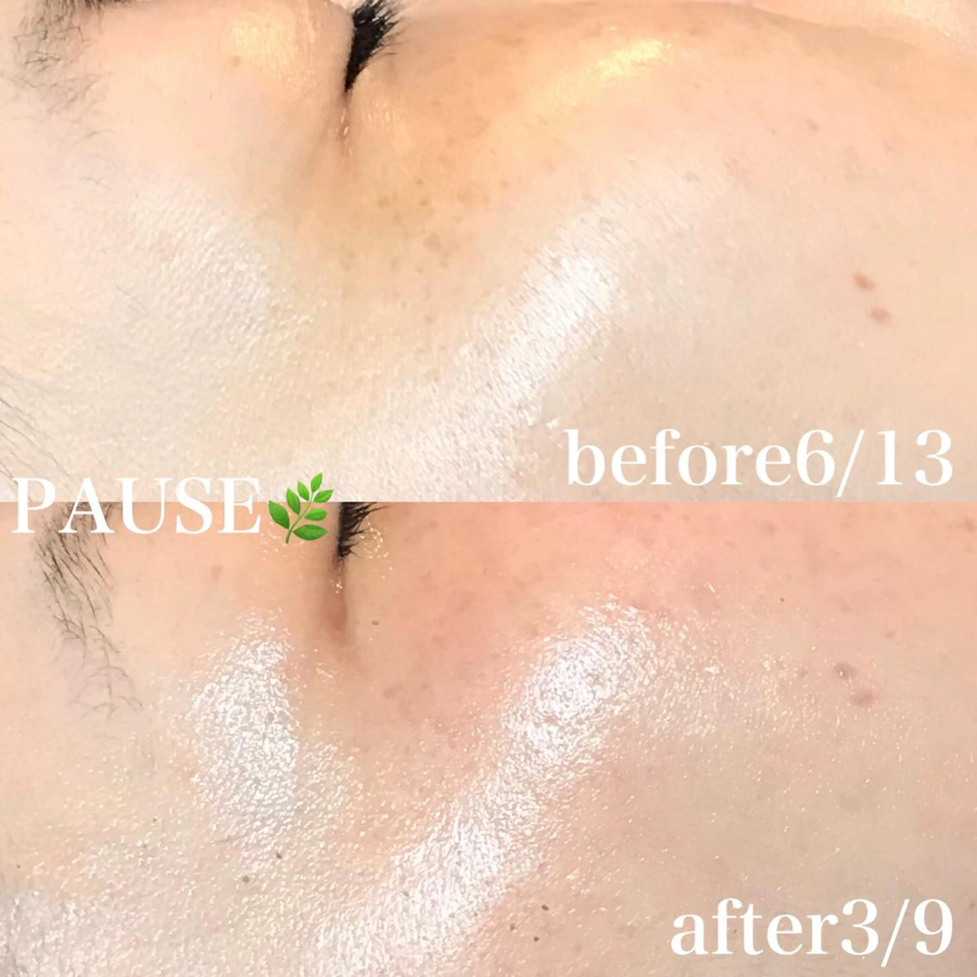 エステ 浜野 恵美のエステ・リラクイメージ