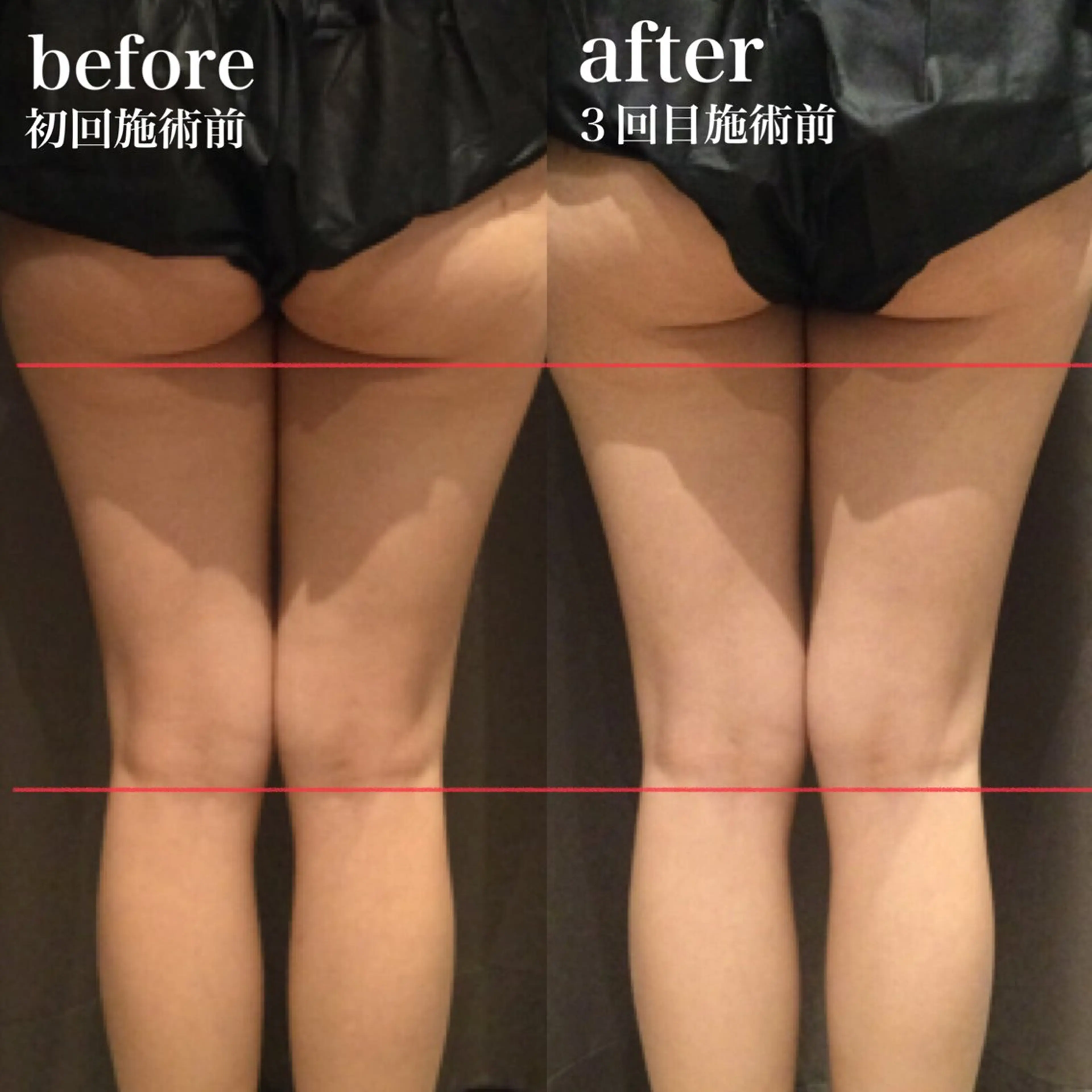 美肌脱毛i所属・美肌脱毛ｉ ｜泉大津のエステ・リラクイメージ